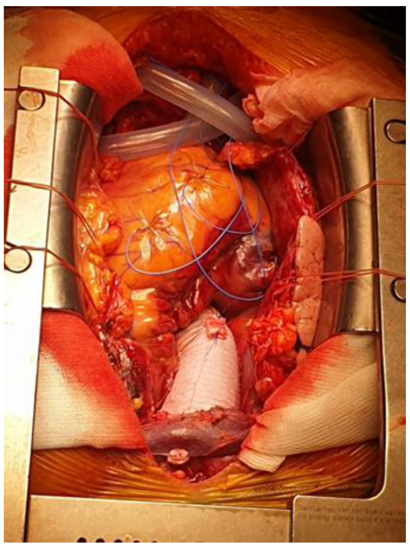 Medicina 60 00027 g002