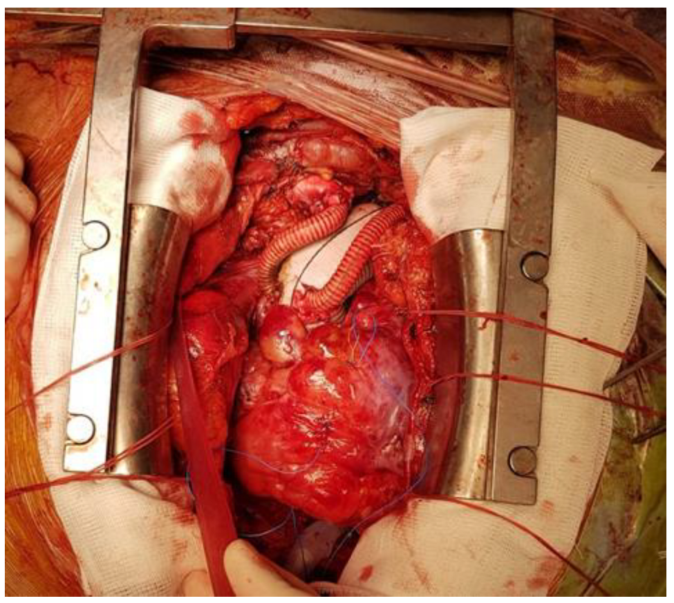 Medicina 60 00027 g003