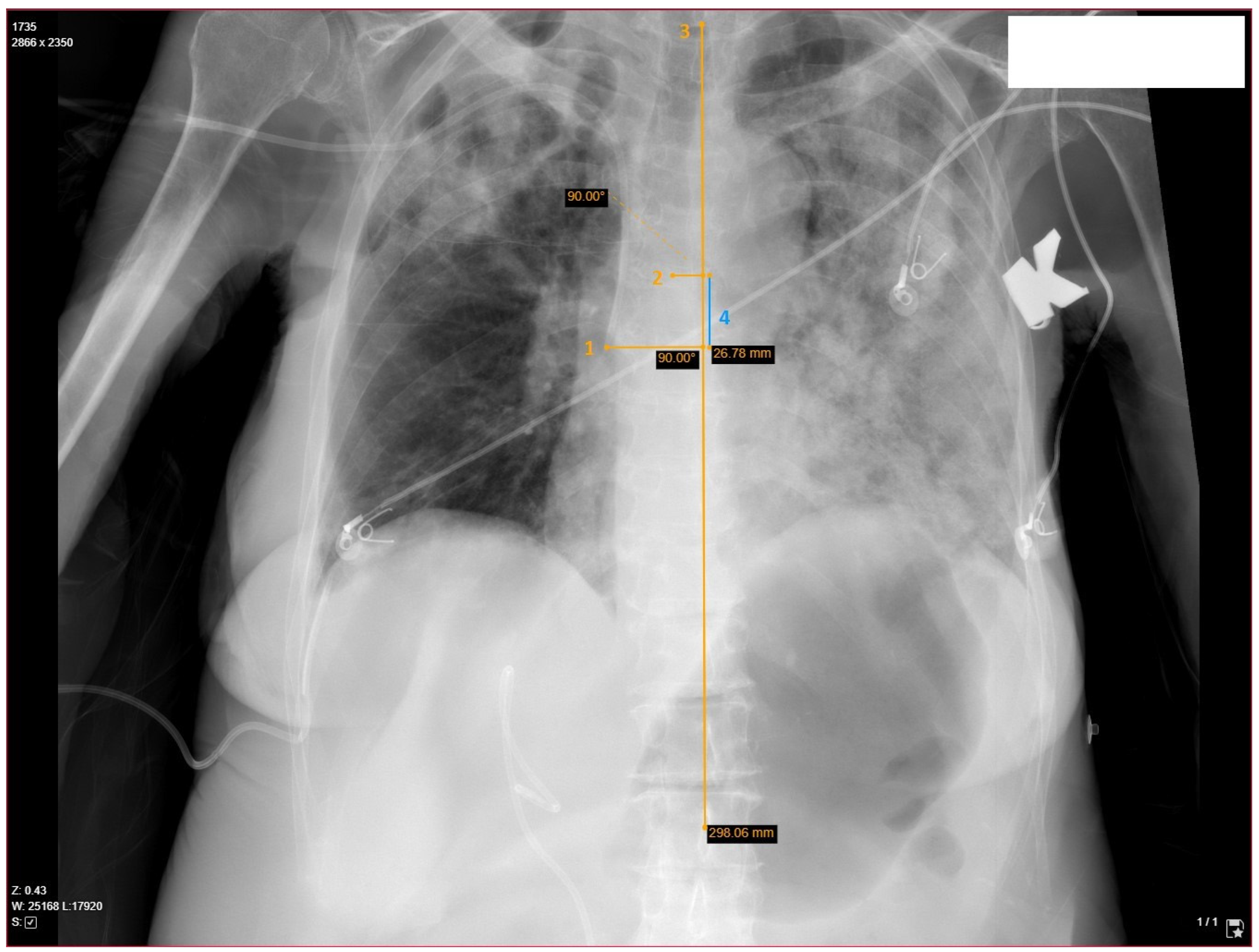 Medicina 60 00028 g001