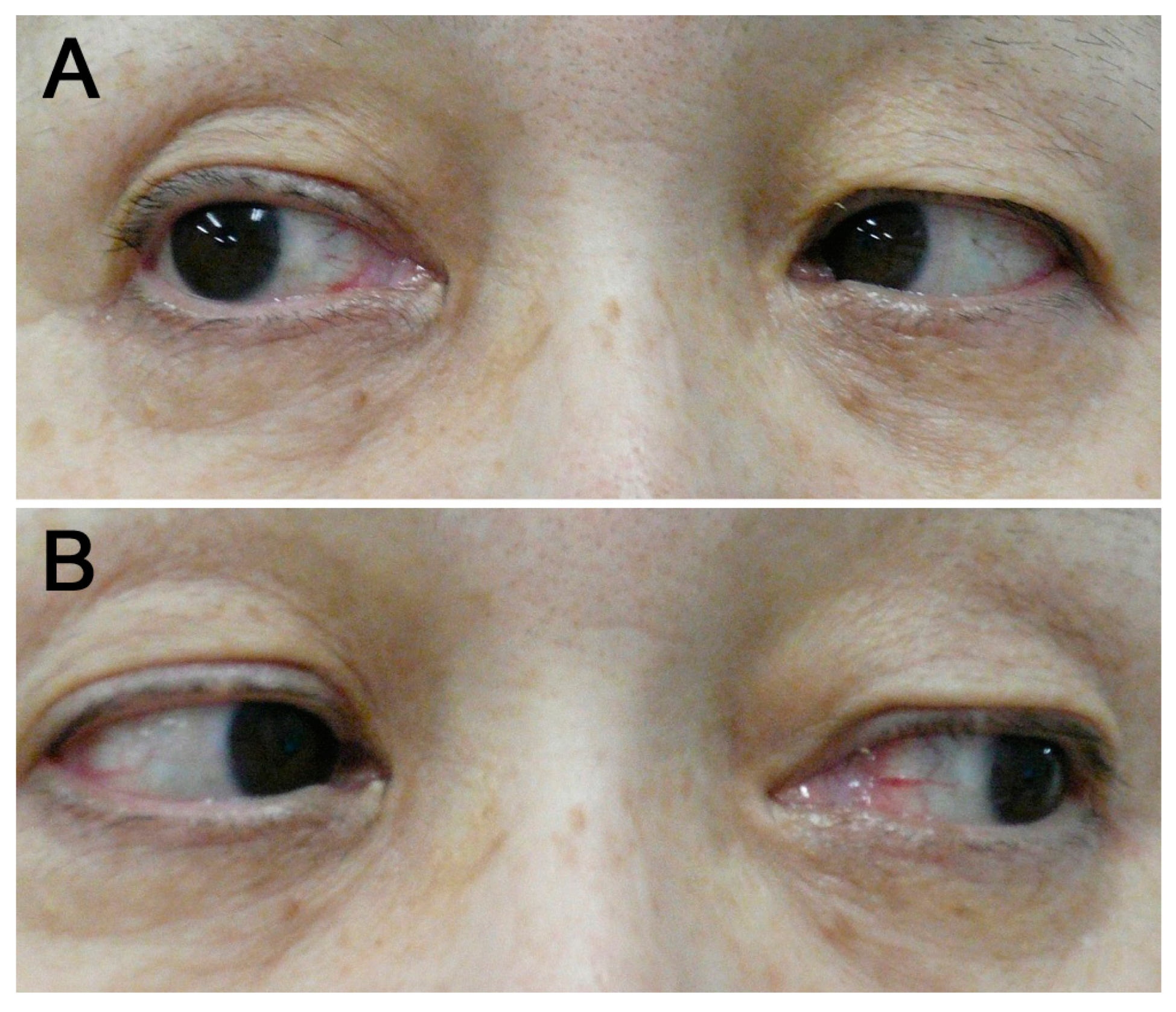 Medicina 60 00036 g002