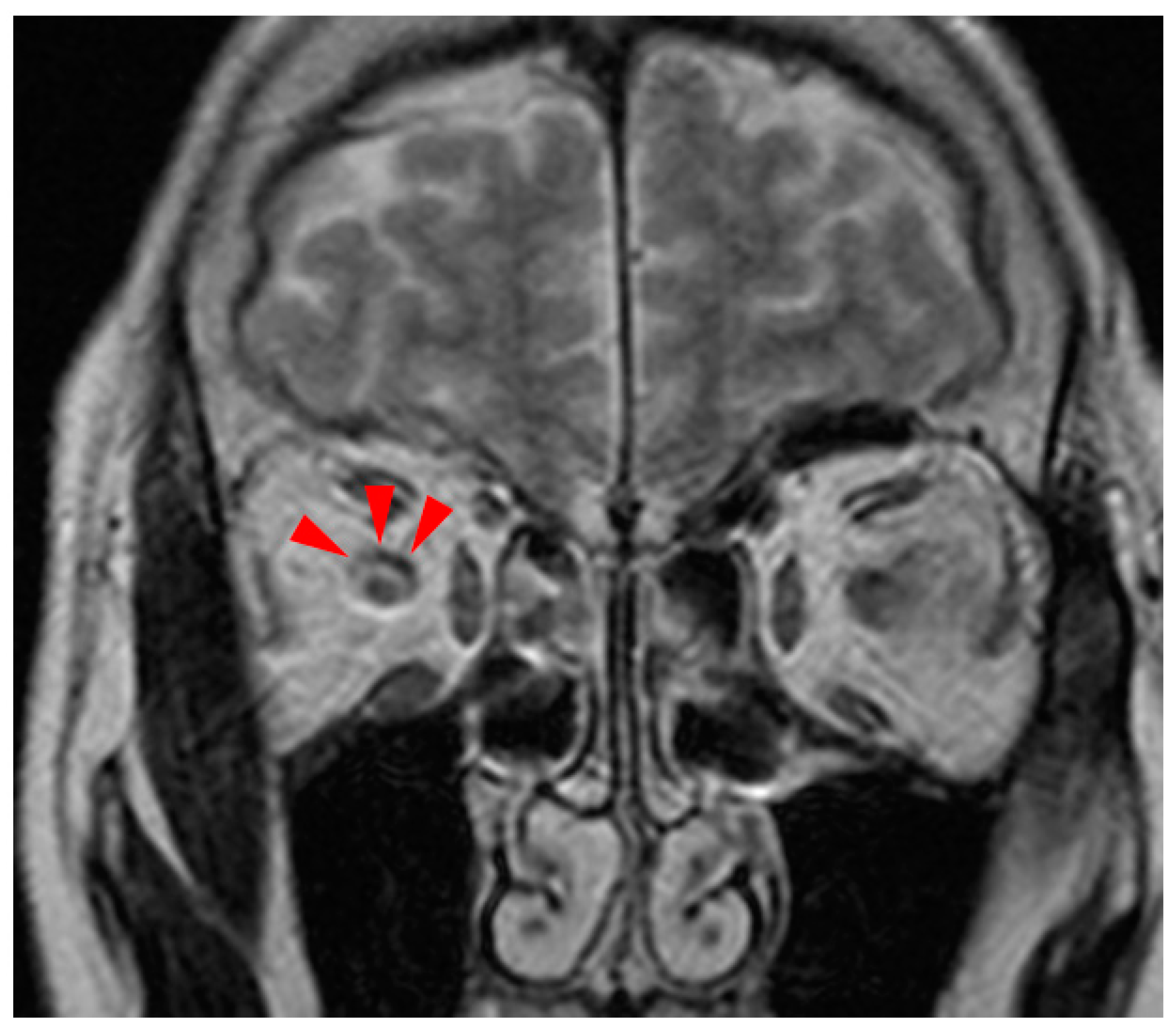 Medicina 60 00036 g003