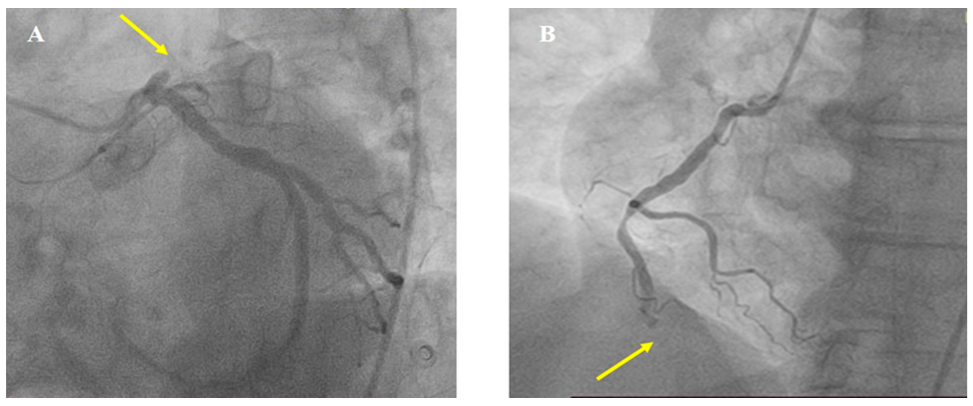 Medicina 60 00039 g004