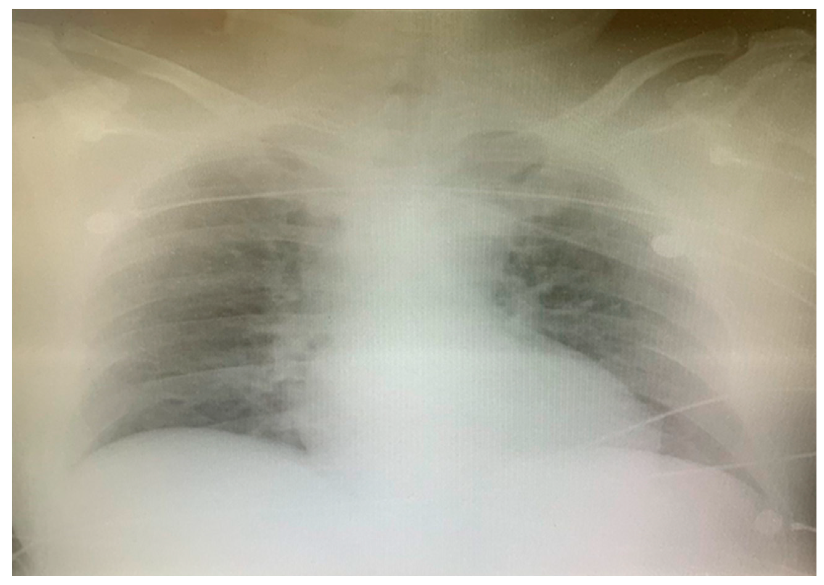 Medicina 60 00039 g007