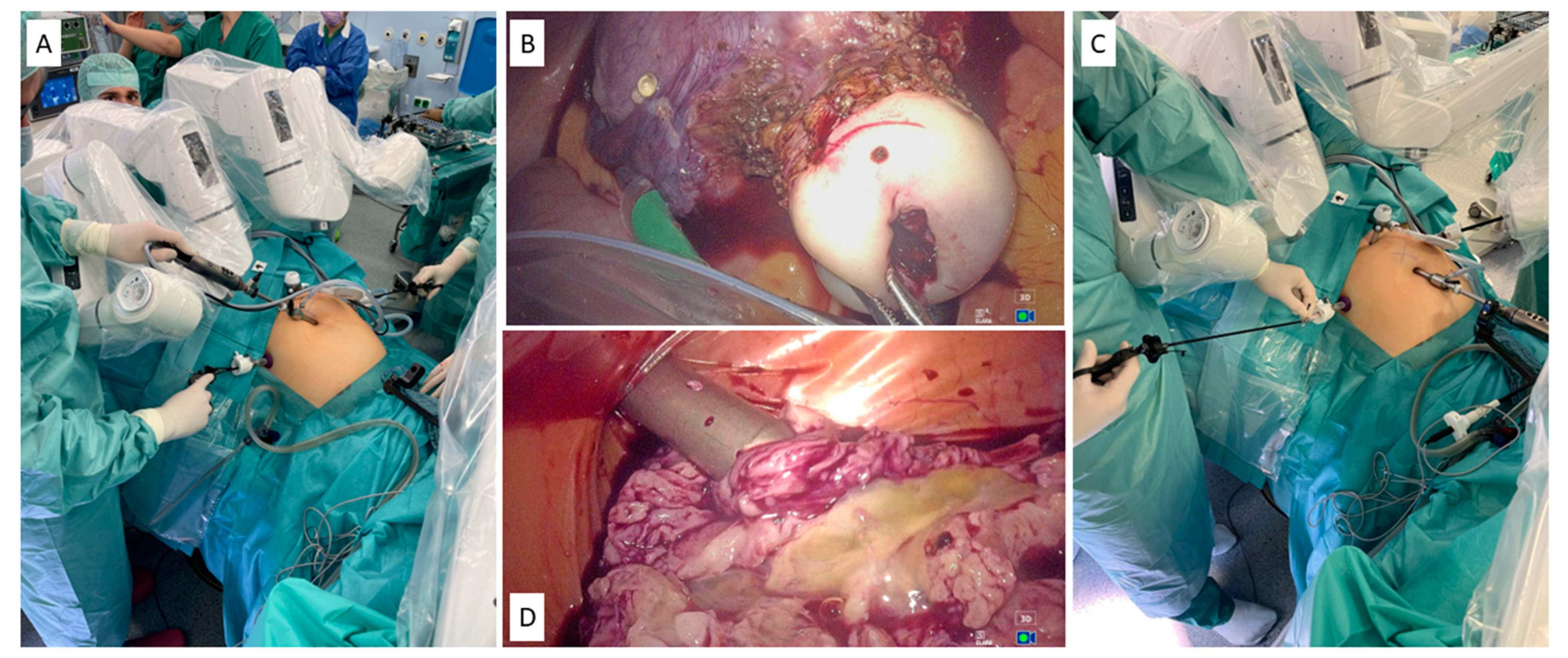 Medicina 60 00053 g003