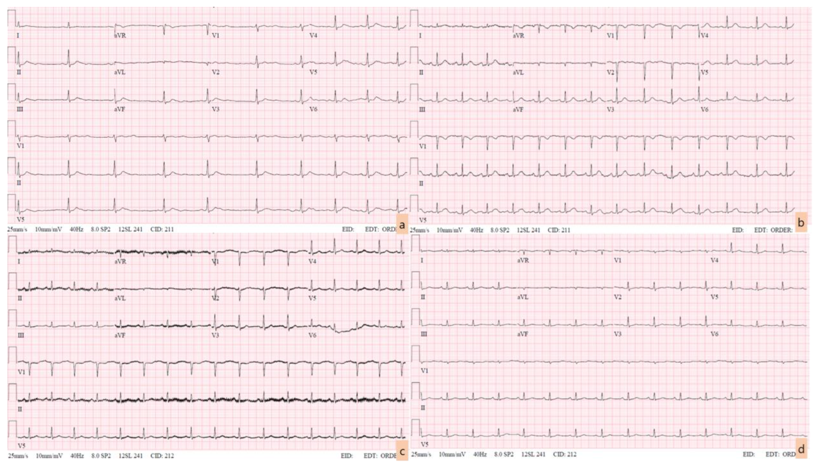 Medicina 60 00055 g001