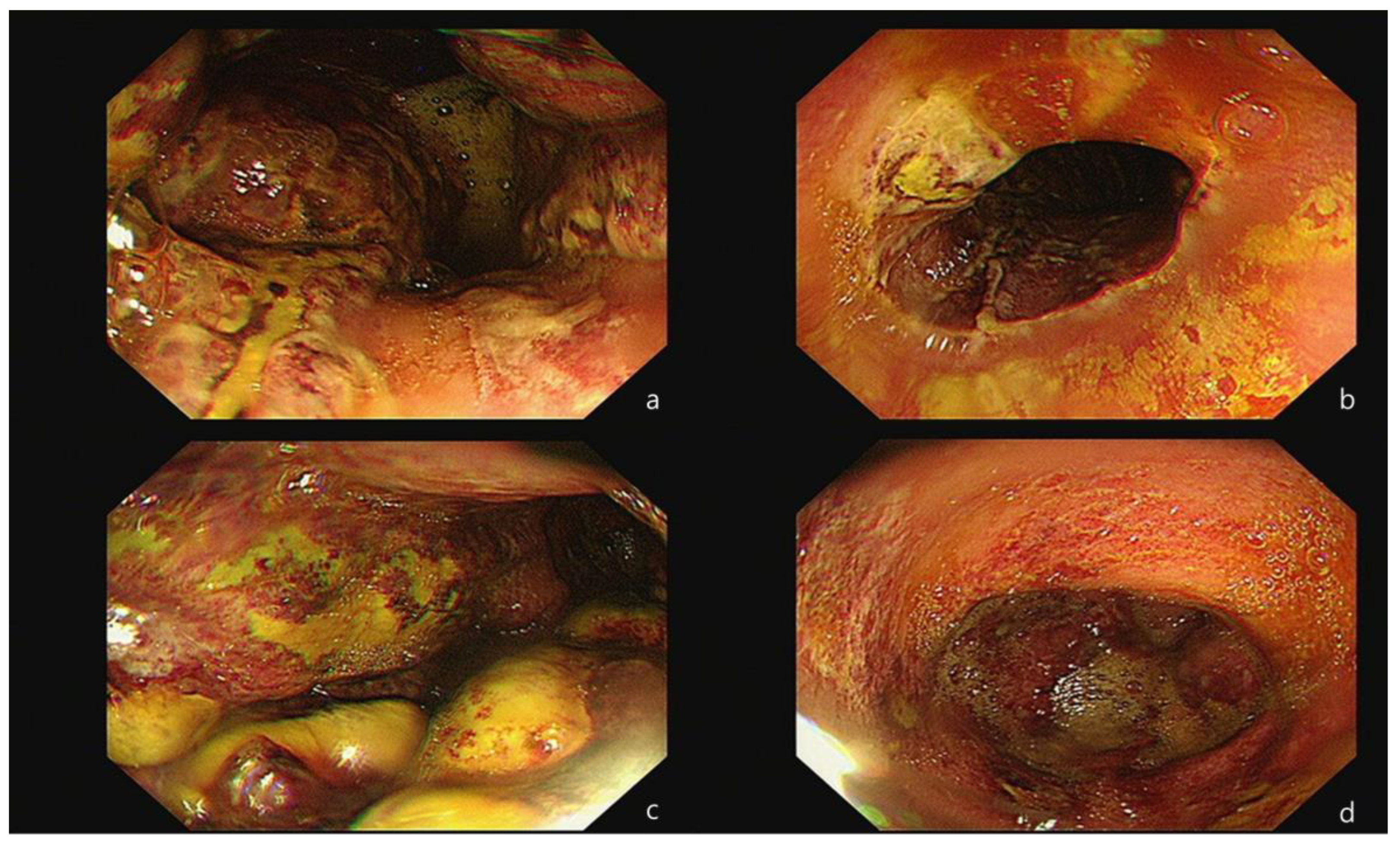 Medicina 60 00055 g002