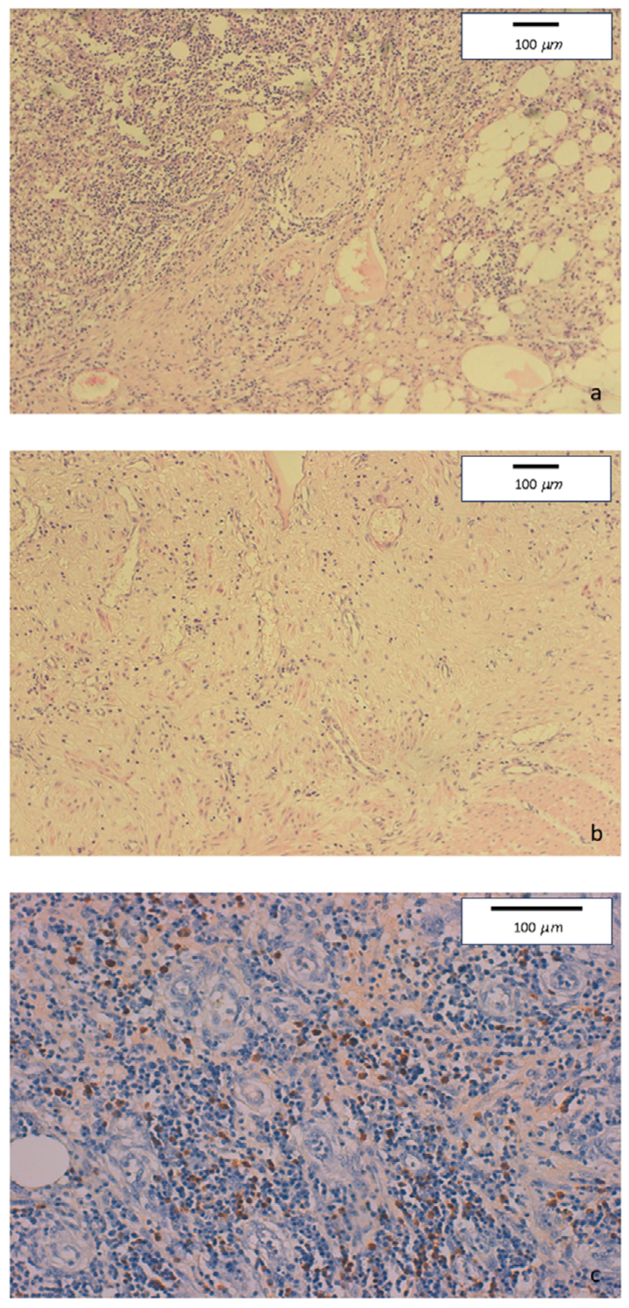 Medicina 60 00057 g002