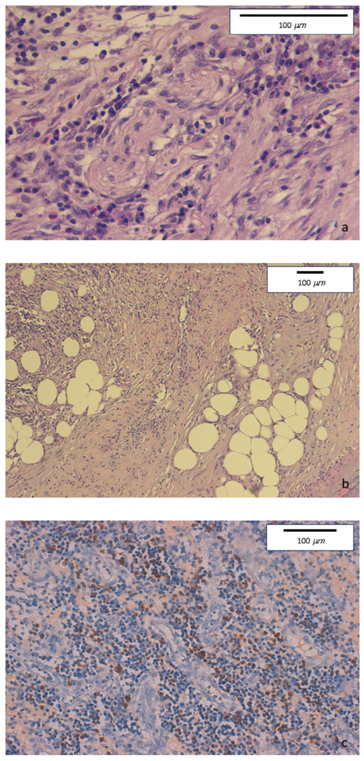 Medicina 60 00057 g003