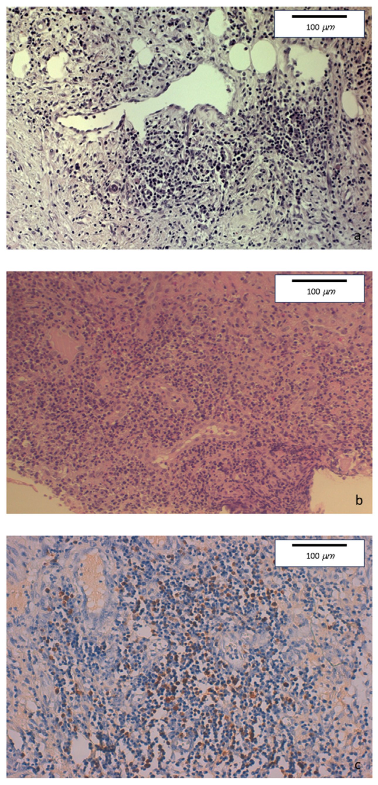 Medicina 60 00057 g004