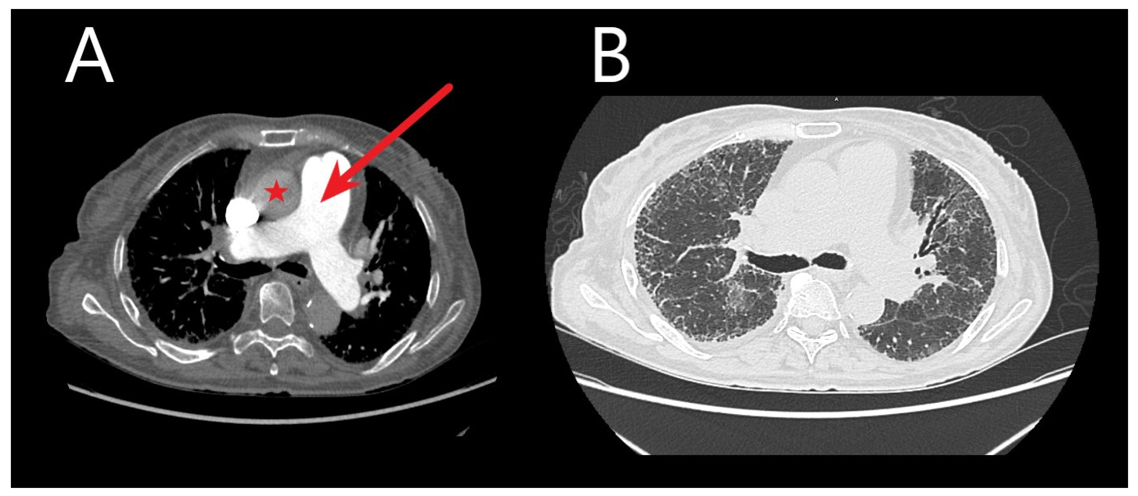 Medicina 60 00058 g001