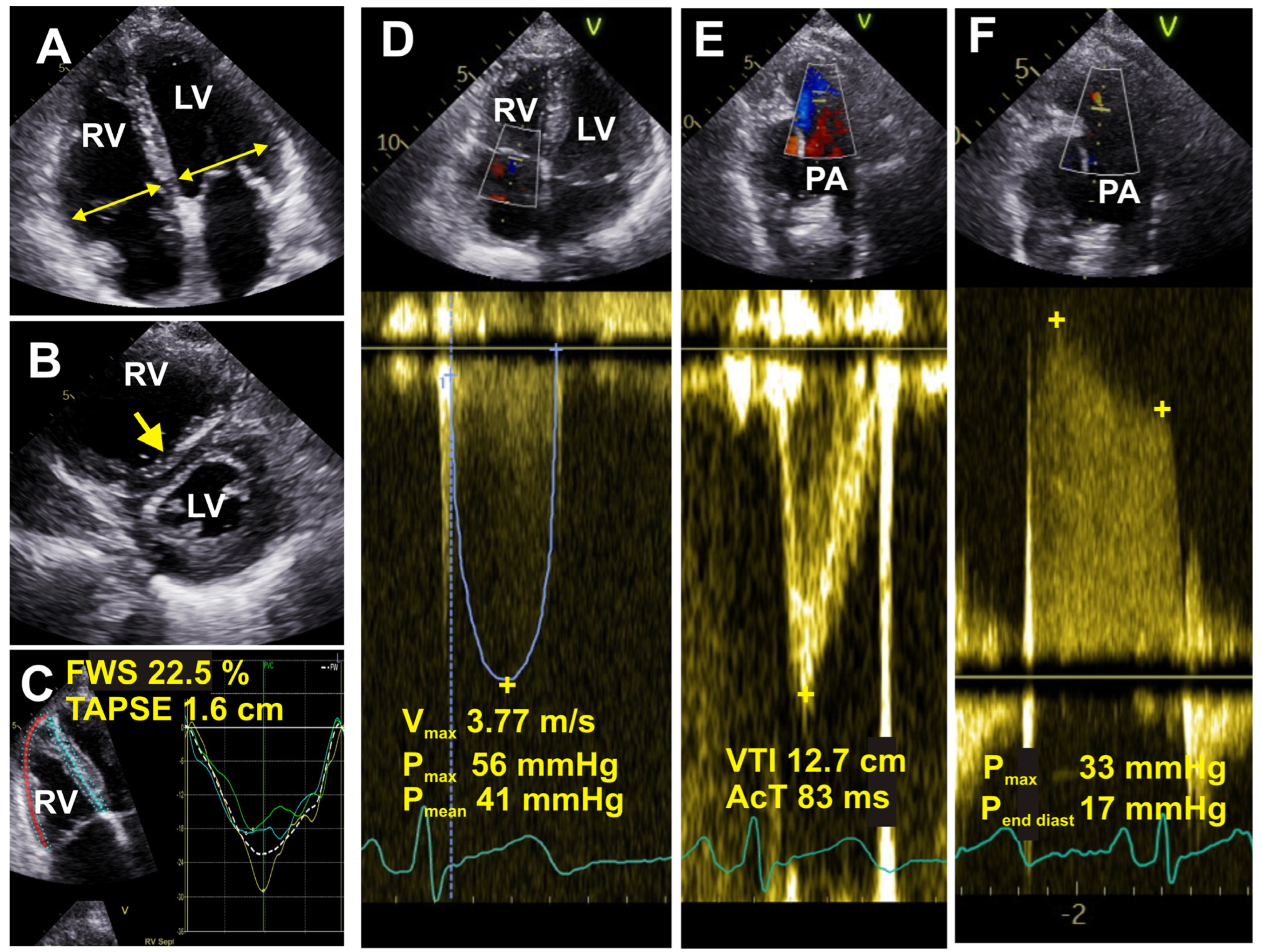 Medicina 60 00058 g002