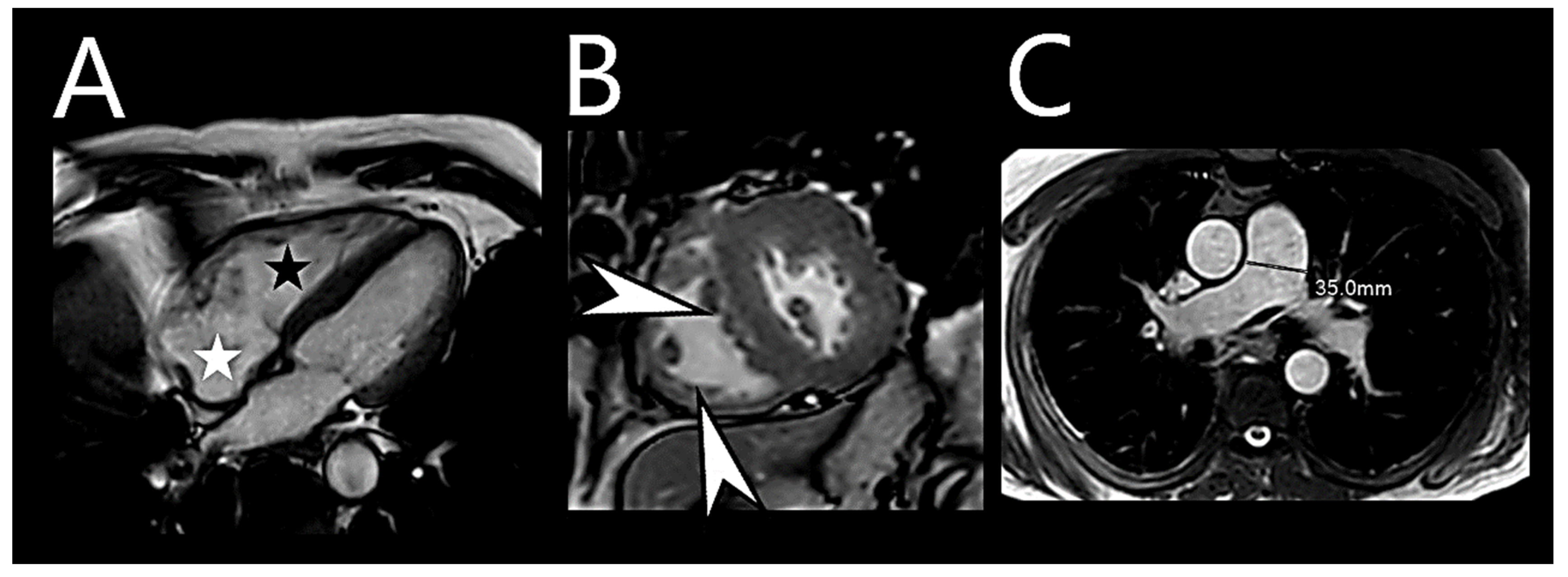 Medicina 60 00058 g003