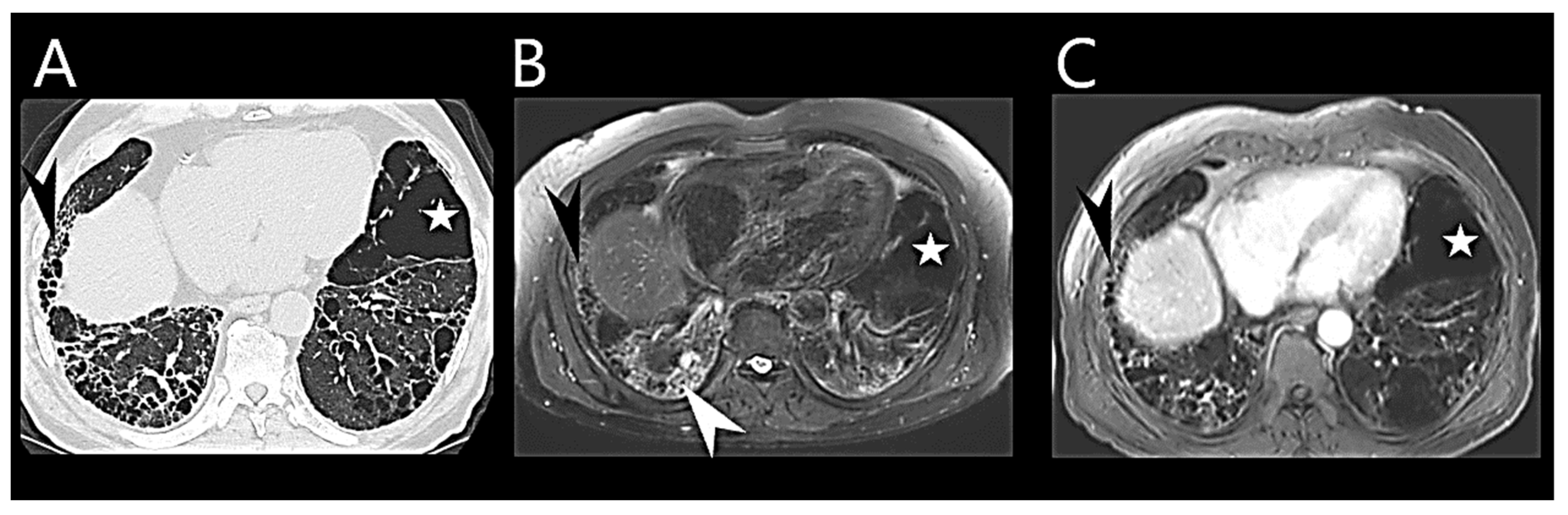 Medicina 60 00058 g004