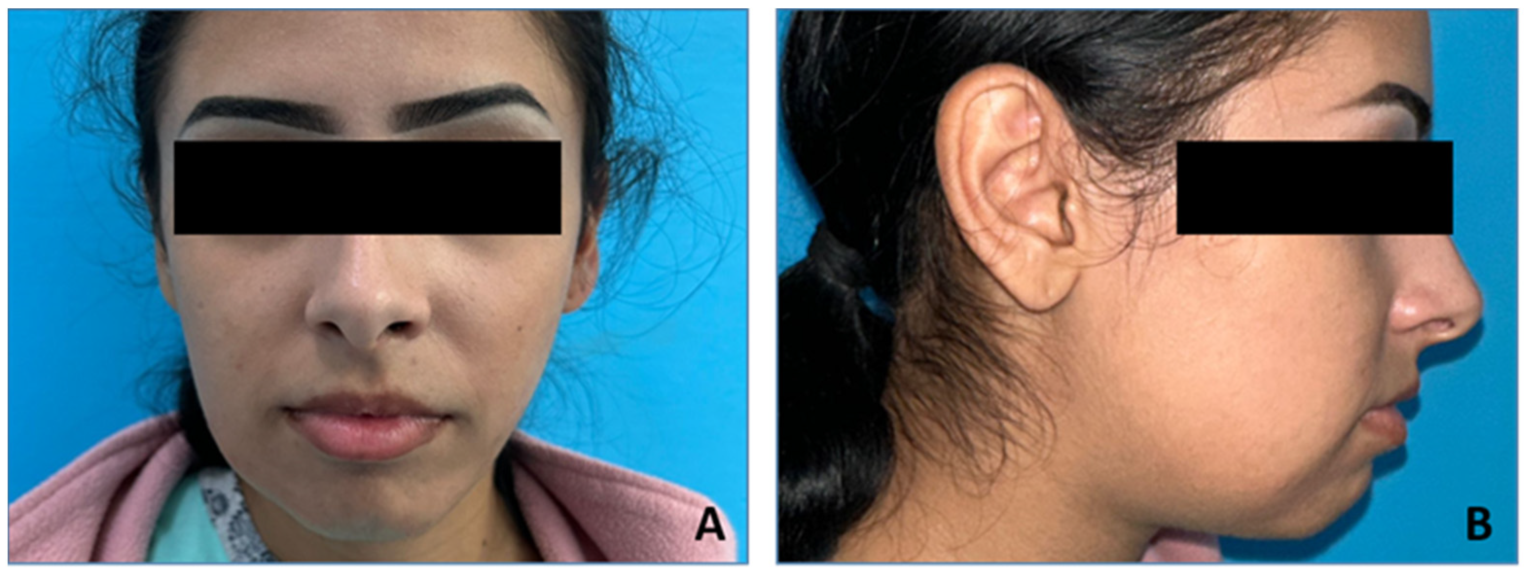 Medicina 60 00066 g001