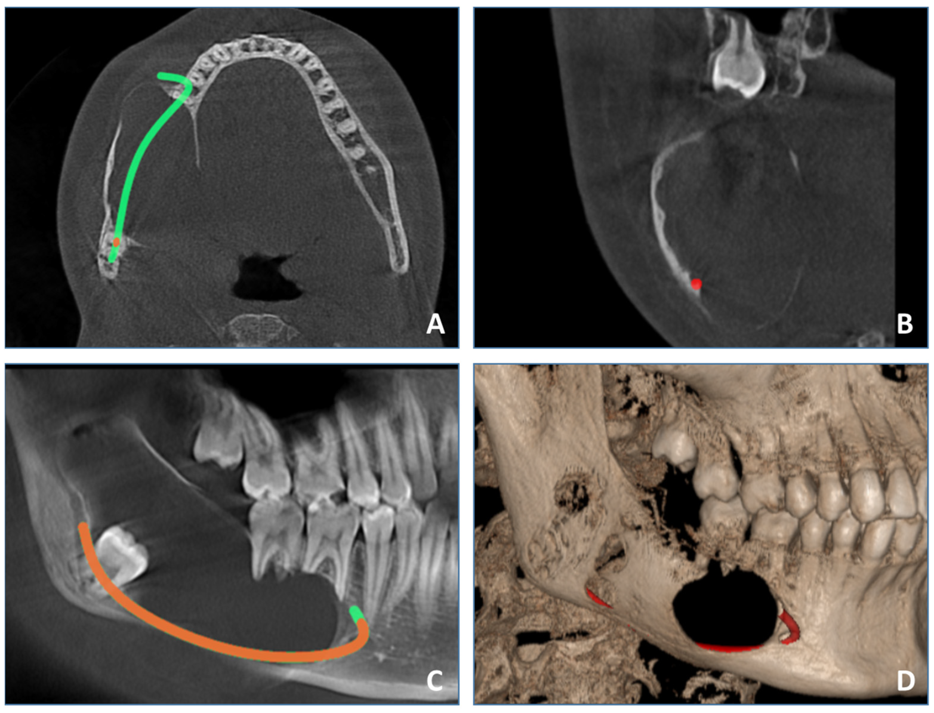 Medicina 60 00066 g003