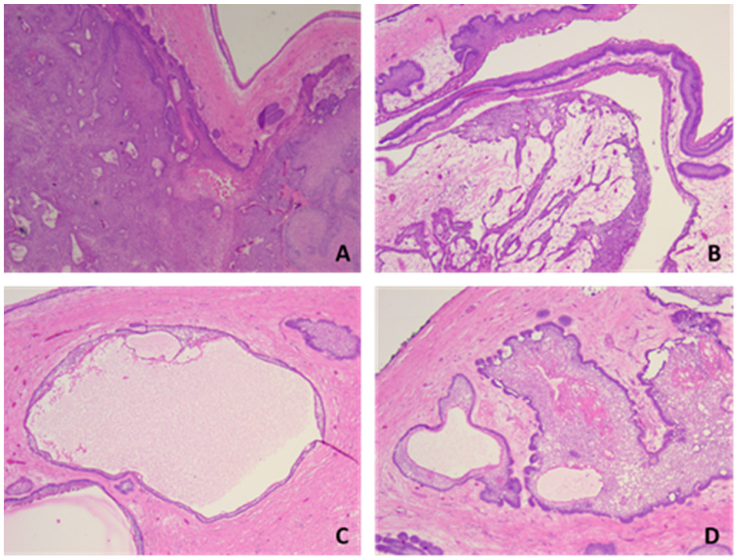 Medicina 60 00066 g004