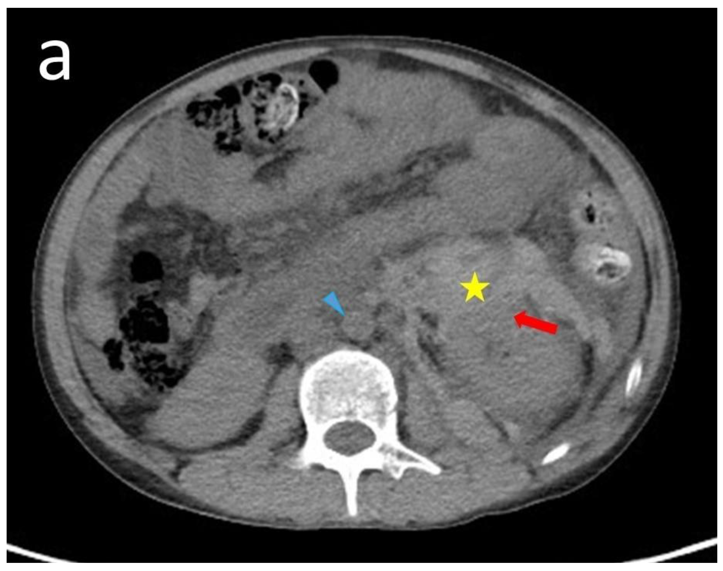 Medicina 60 00078 g001a