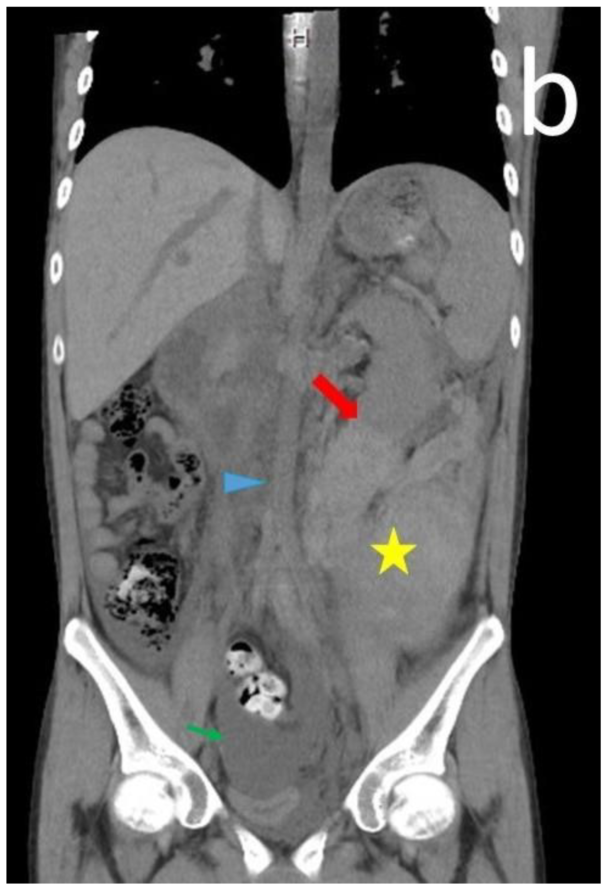 Medicina 60 00078 g001b