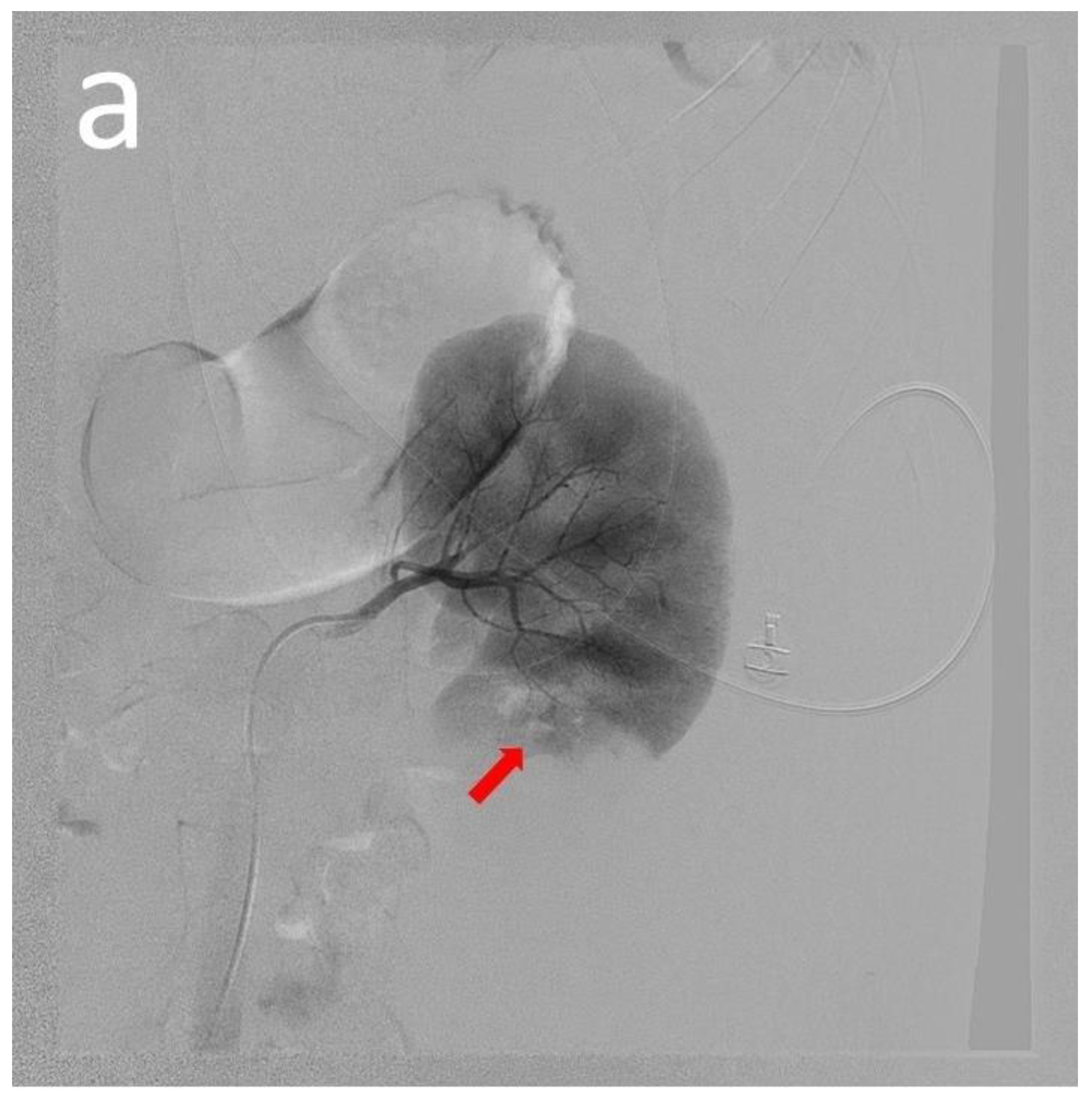Medicina 60 00078 g002a