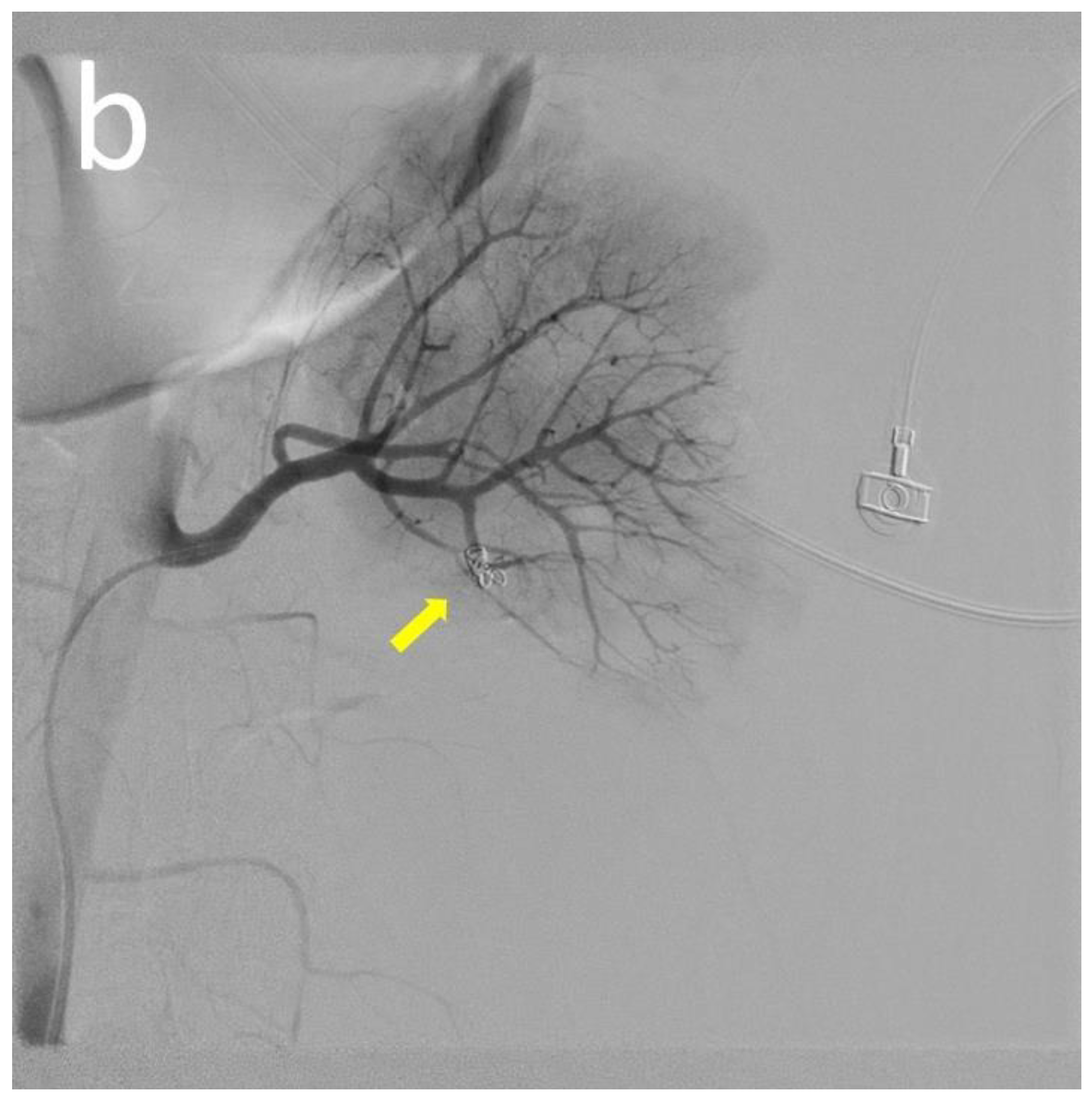 Medicina 60 00078 g002b