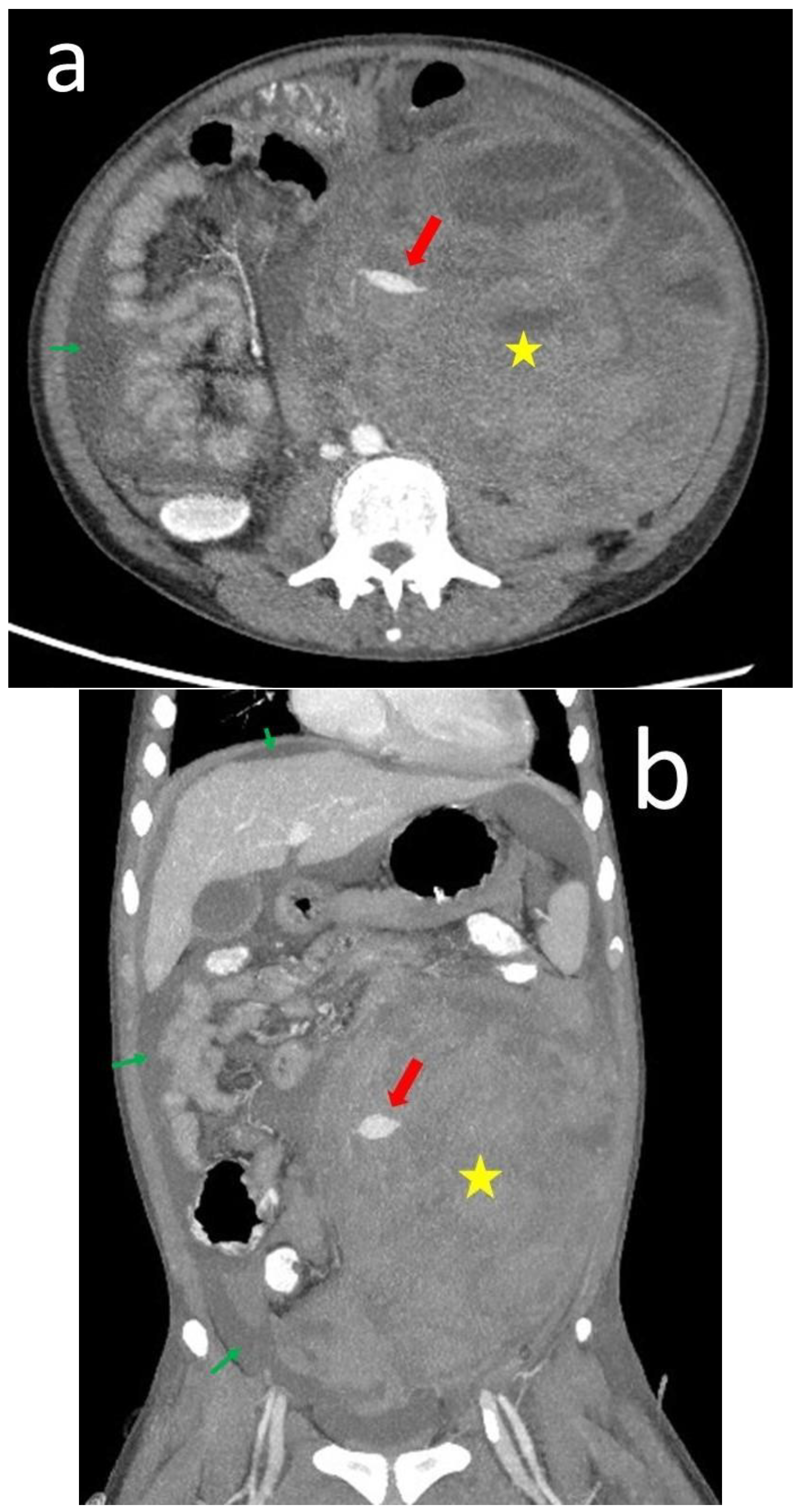 Medicina 60 00078 g003