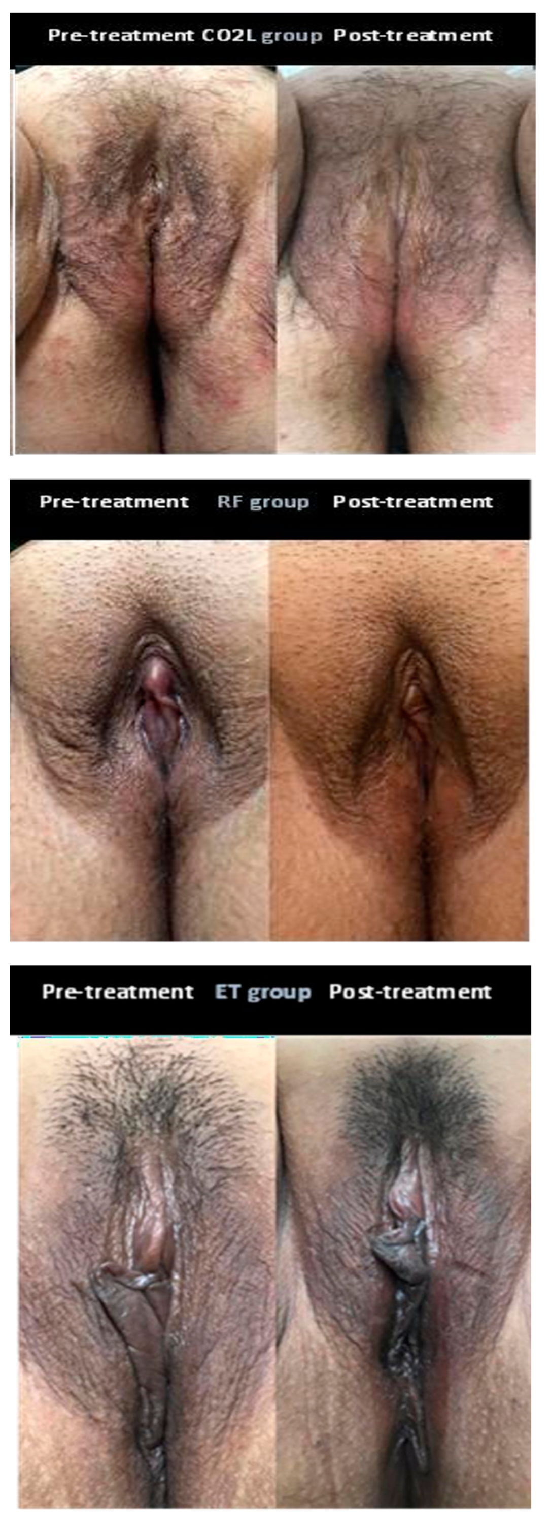 Medicina 60 00080 g002