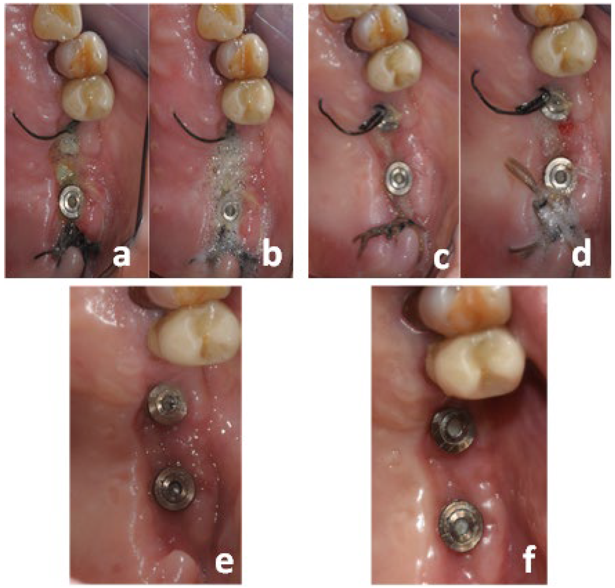 Medicina 60 00096 g004