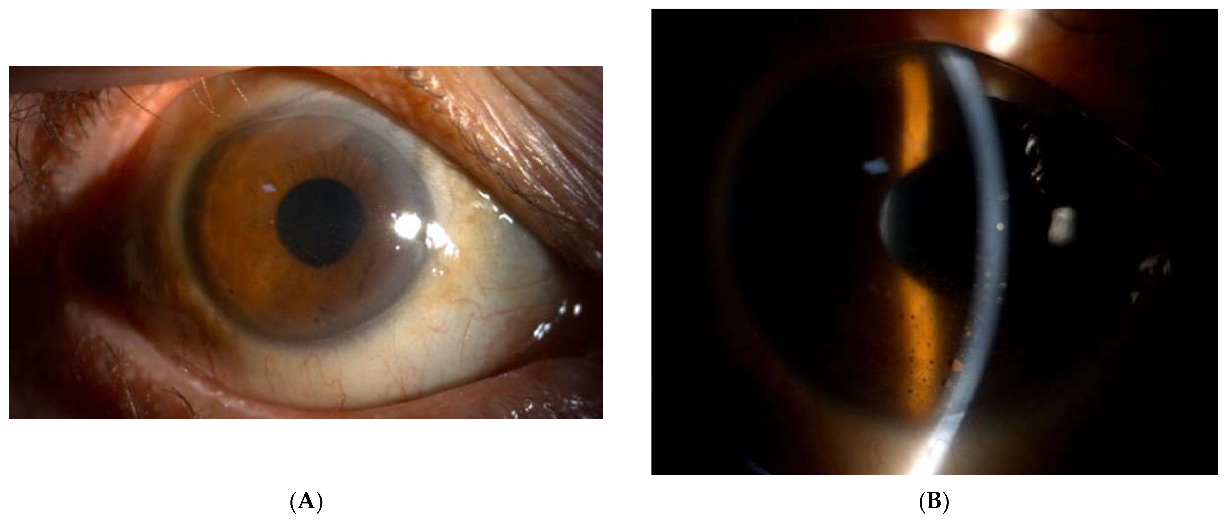 Medicina 60 00097 g003