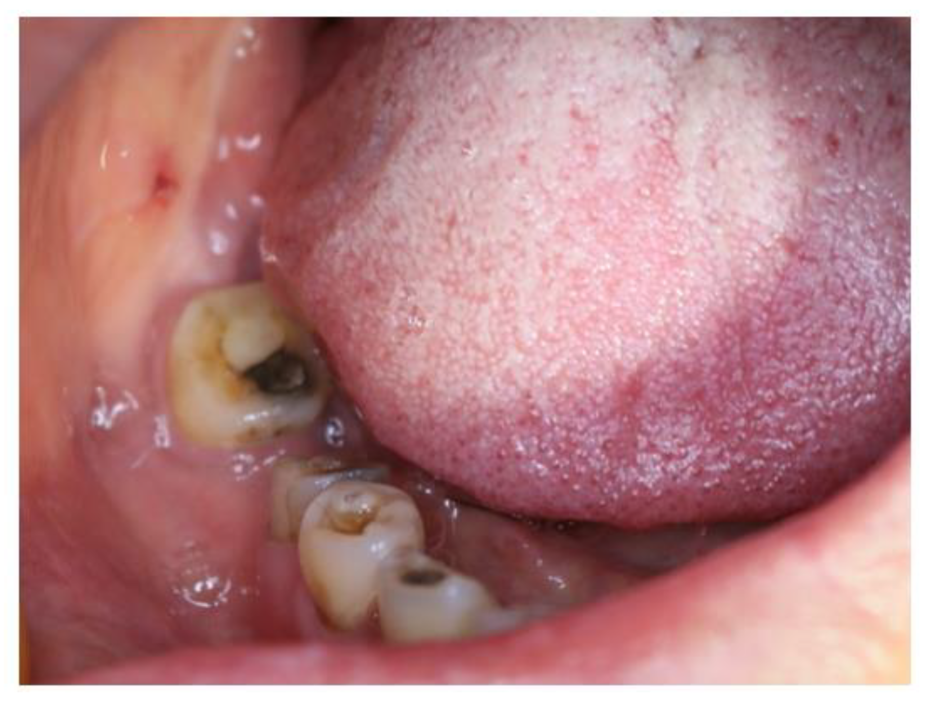 Medicina 60 00100 g001 Medicina 60 00100 g001