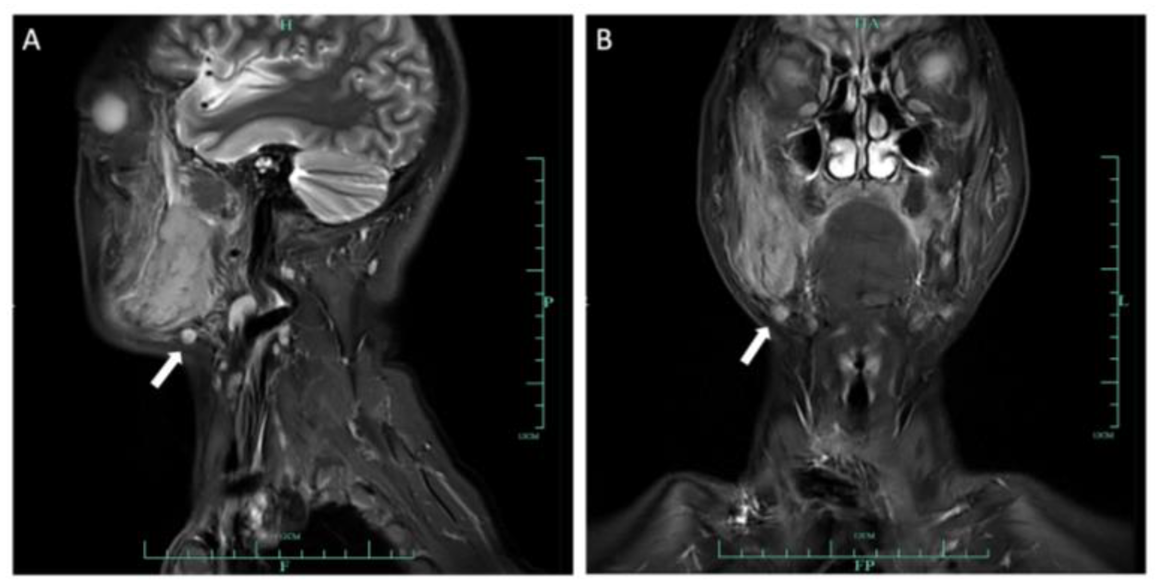 Medicina 60 00100 g005 Medicina 60 00100 g005