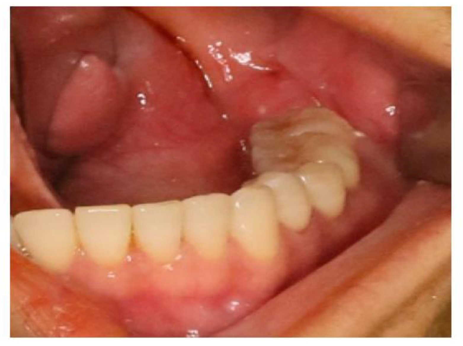 Medicina 60 00100 g010 Medicina 60 00100 g010