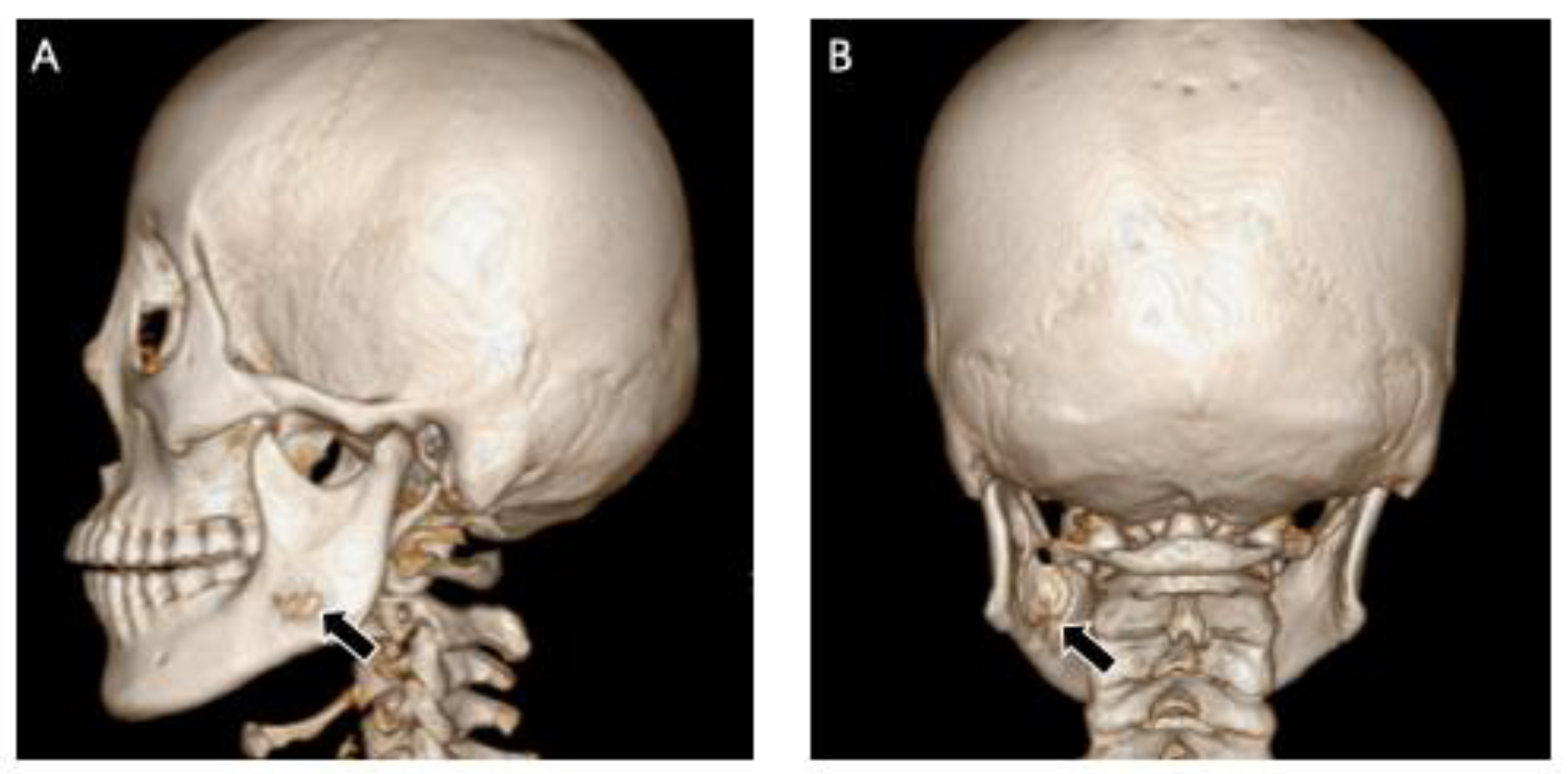 Medicina 60 00100 g013 Medicina 60 00100 g013