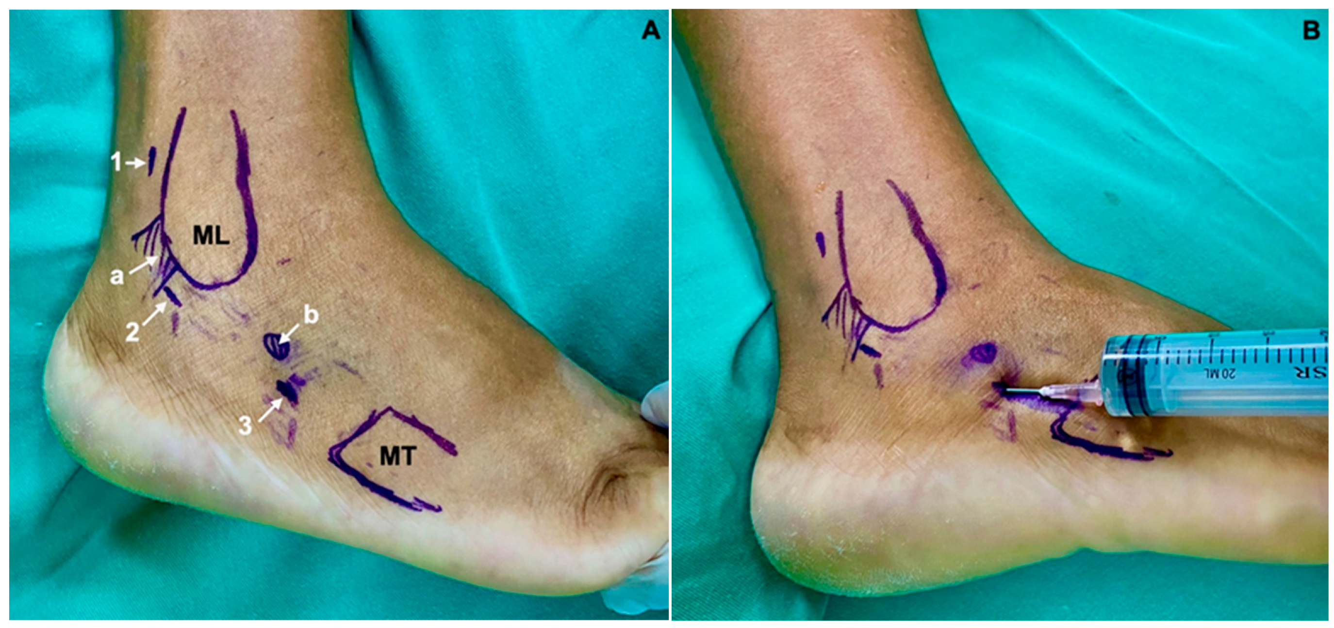 Medicina 60 00104 g002