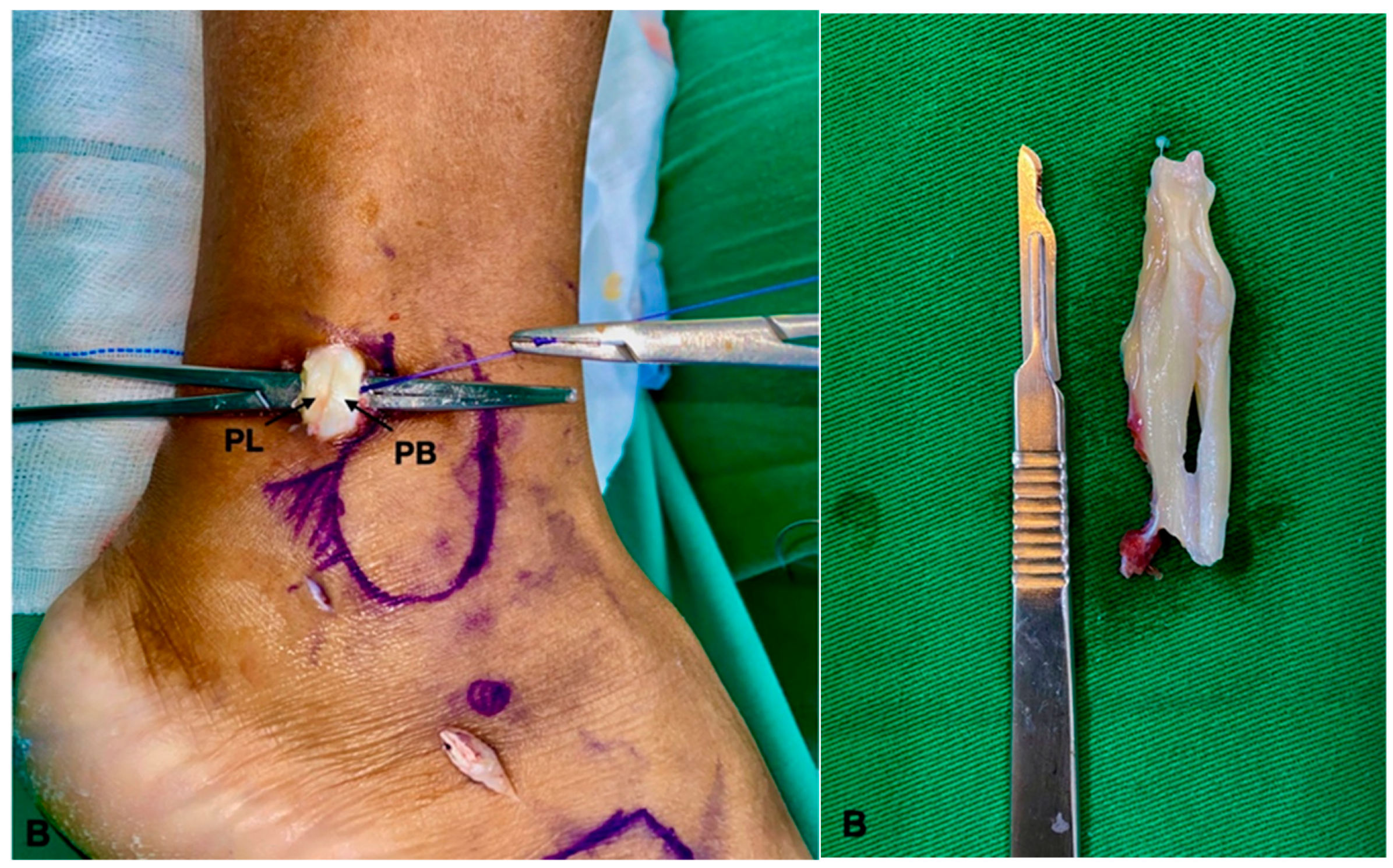 Medicina 60 00104 g006