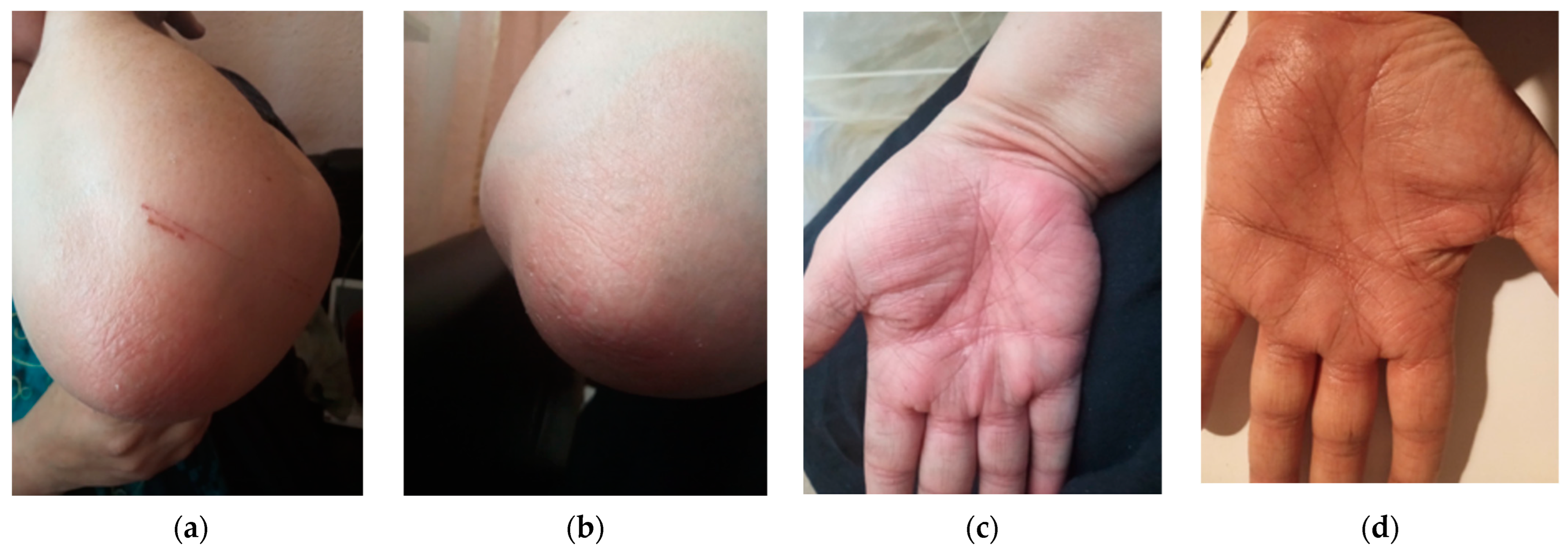 Medicina 60 00106 g003