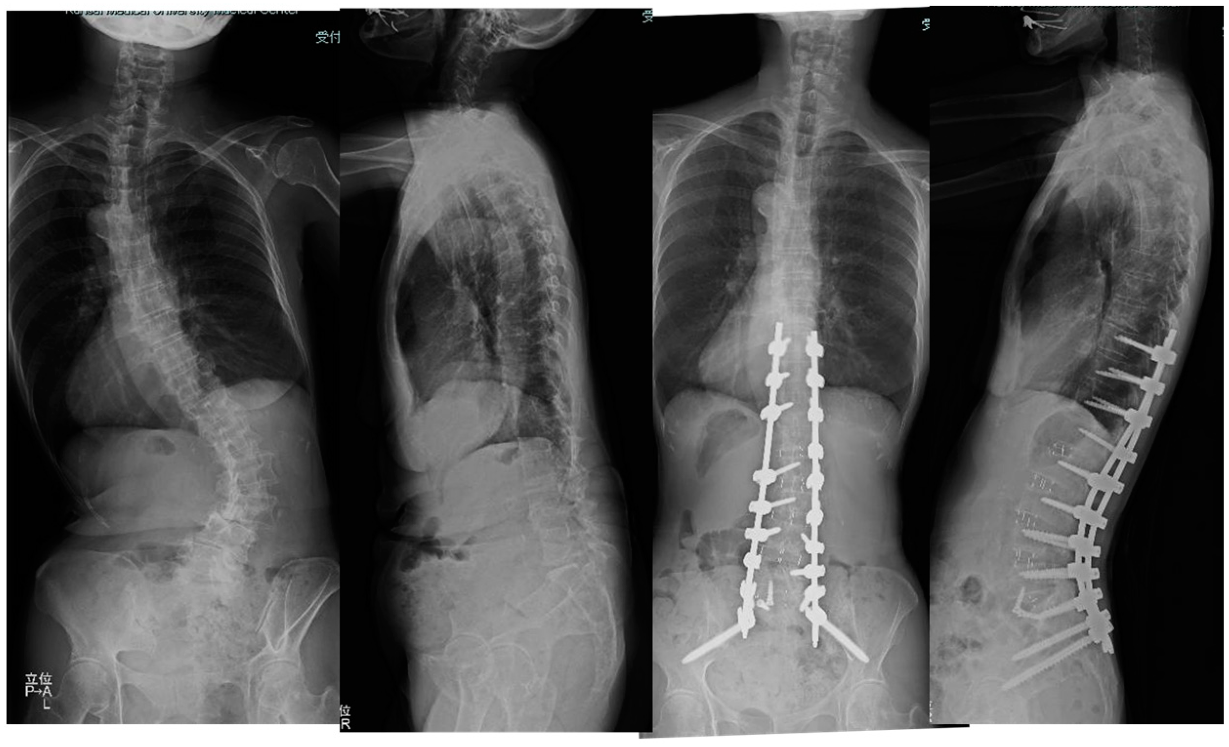 Medicina 60 00107 g006