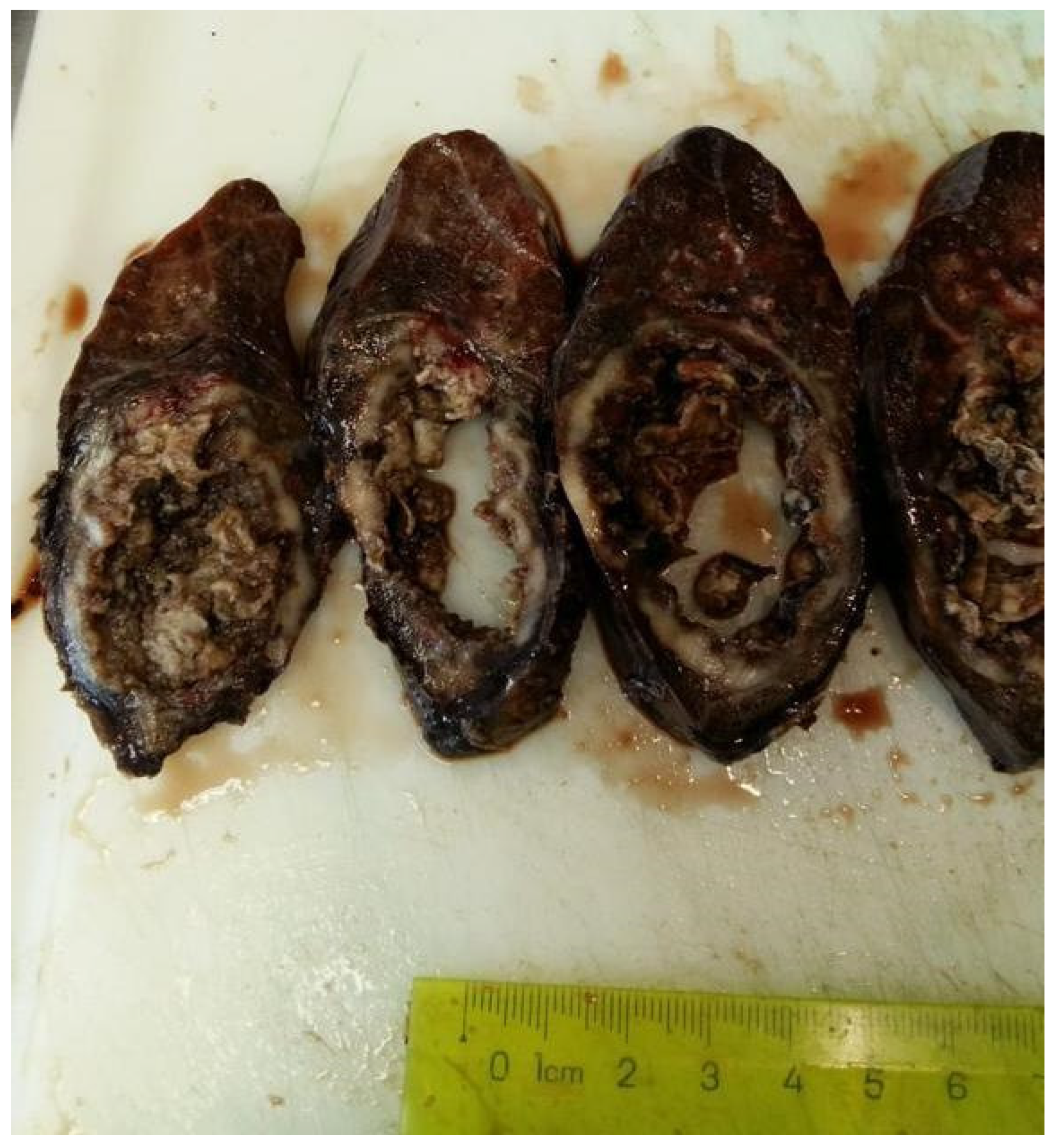 Medicina 60 00112 g003