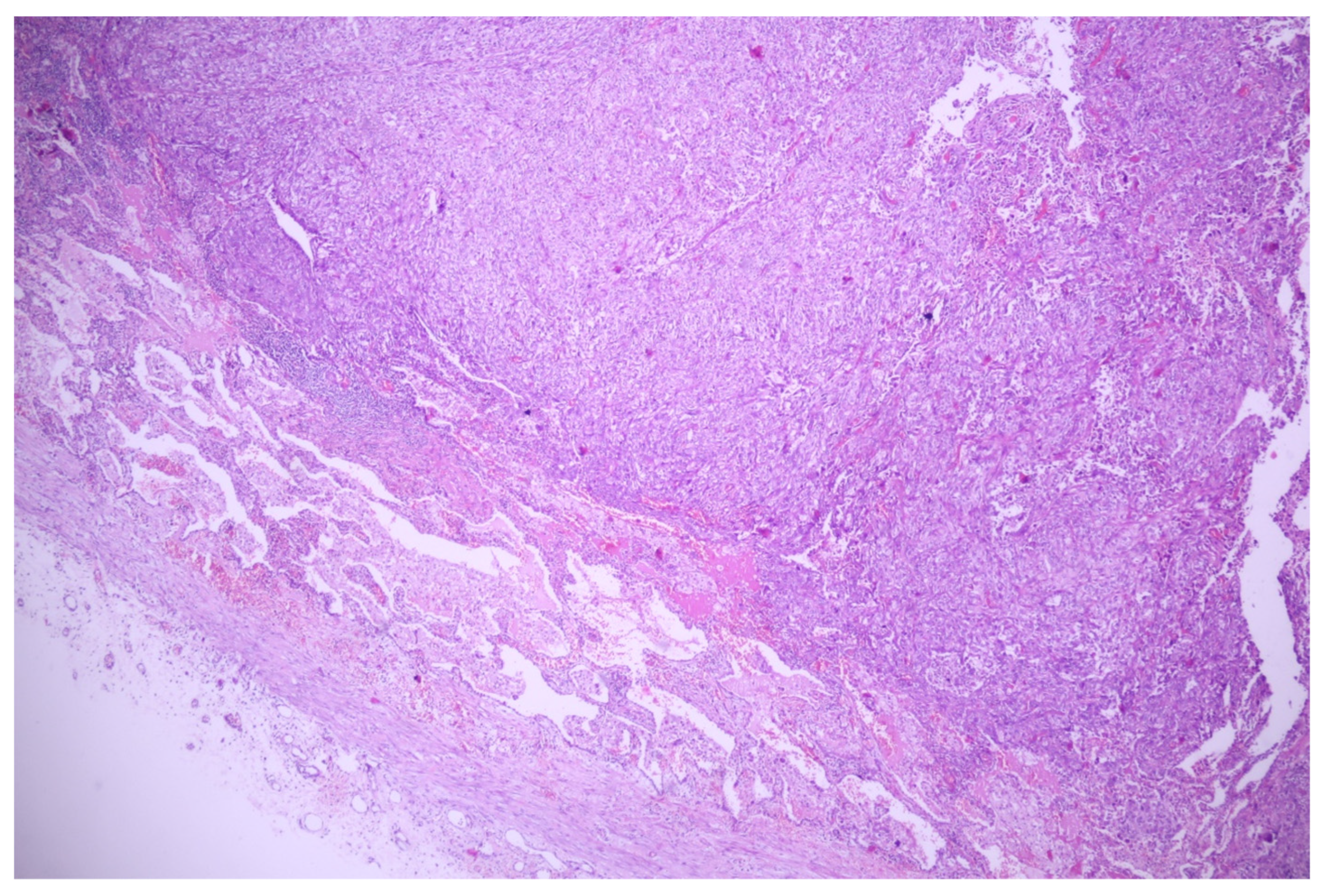 Medicina 60 00112 g004