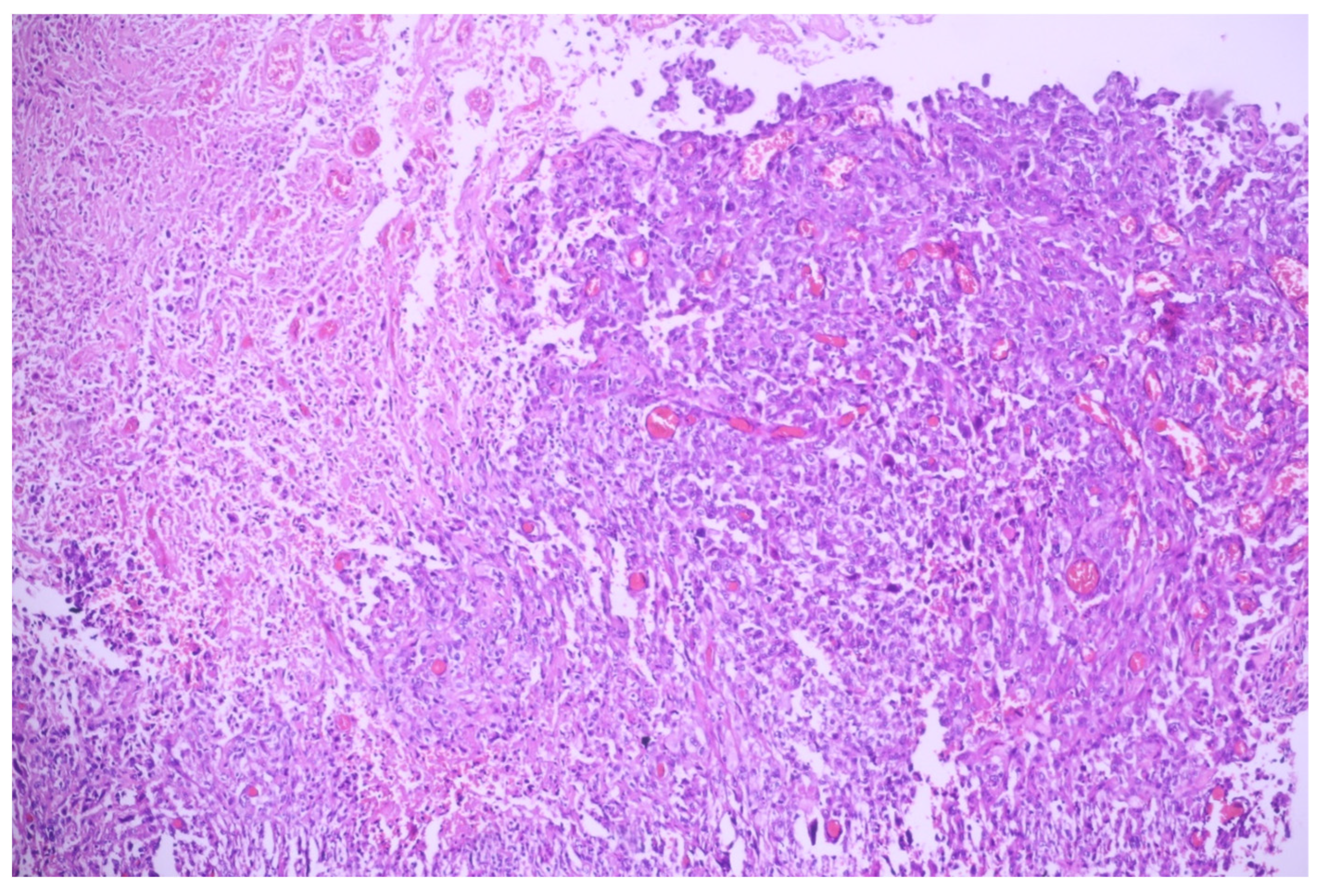 Medicina 60 00112 g005