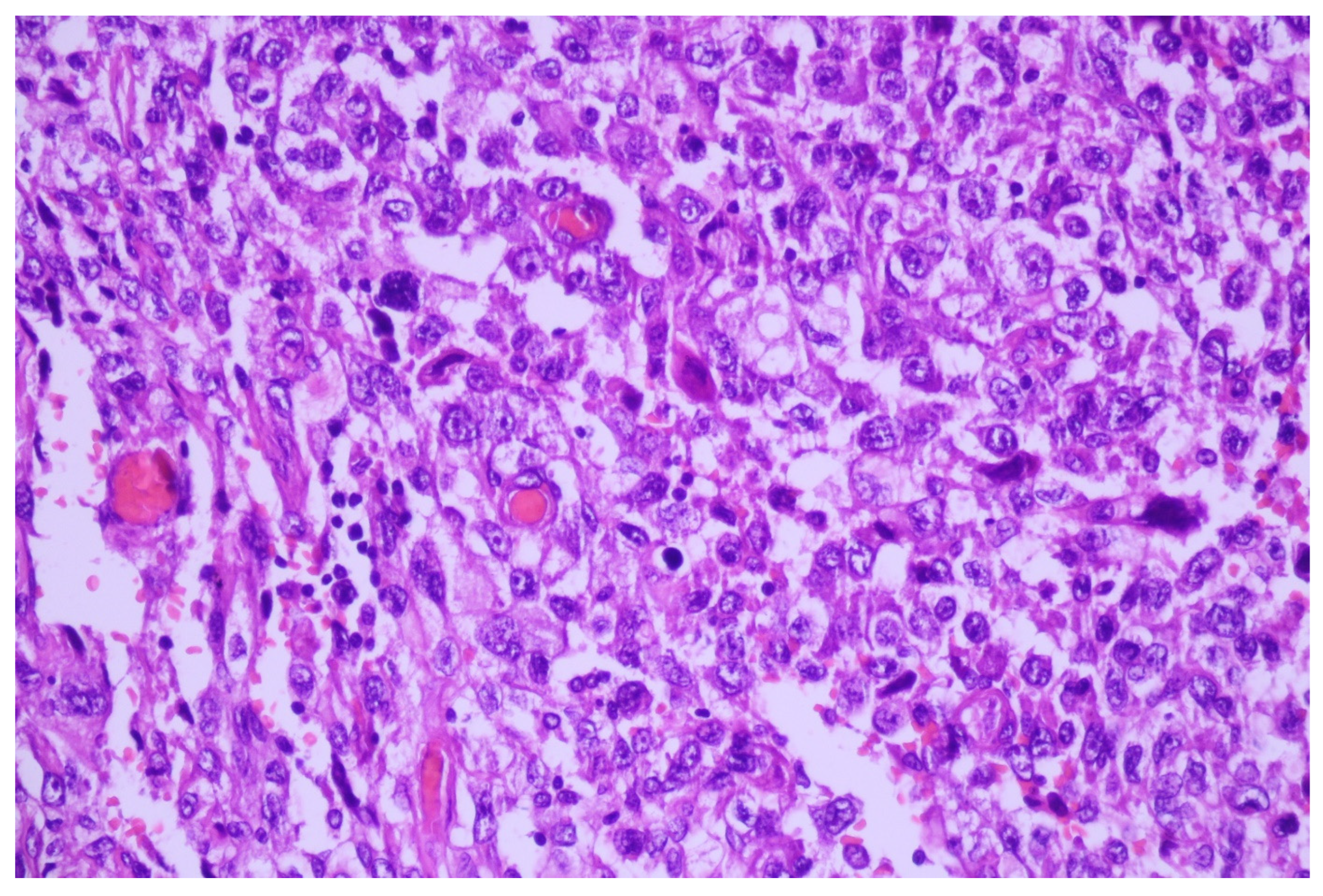 Medicina 60 00112 g006