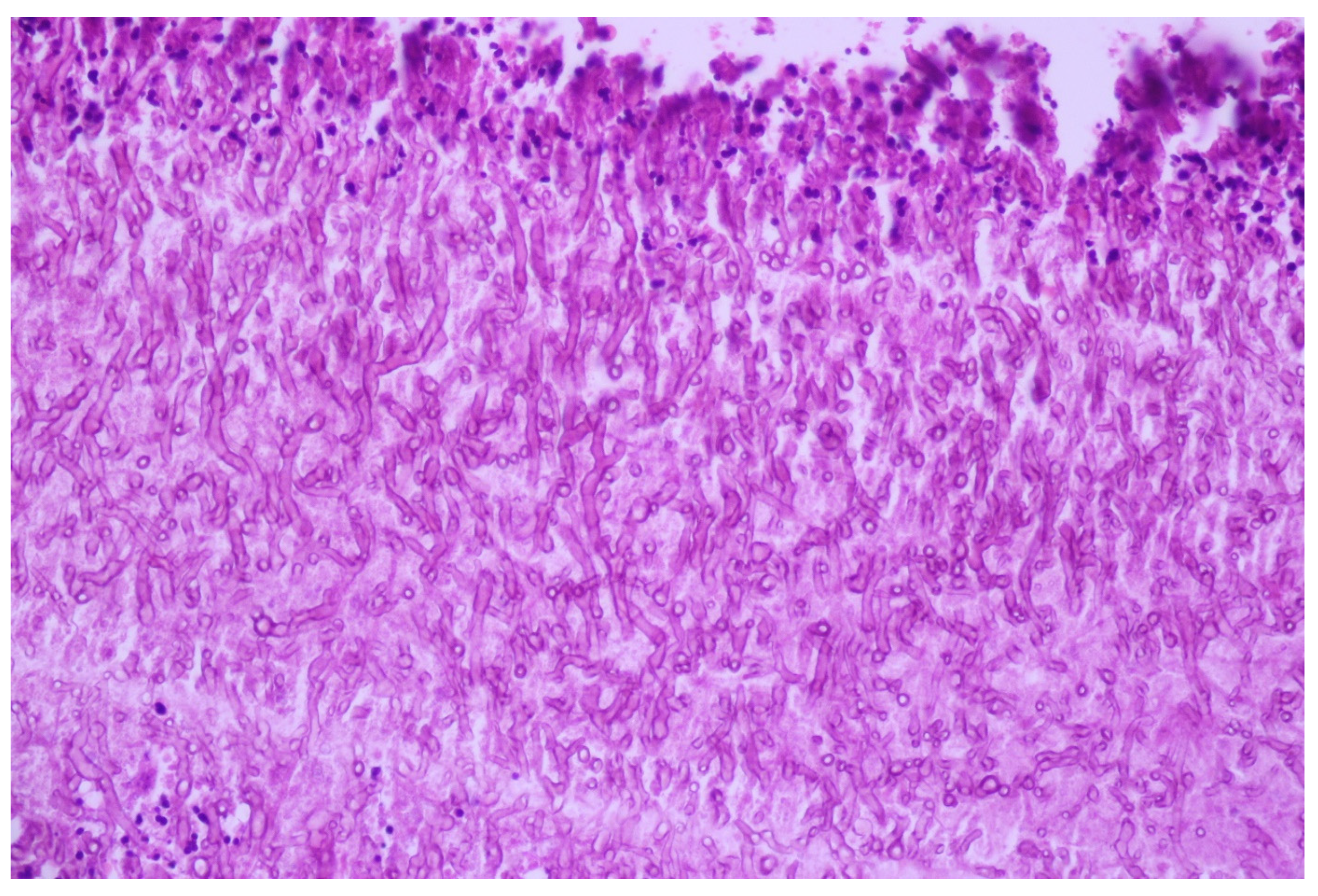 Medicina 60 00112 g008