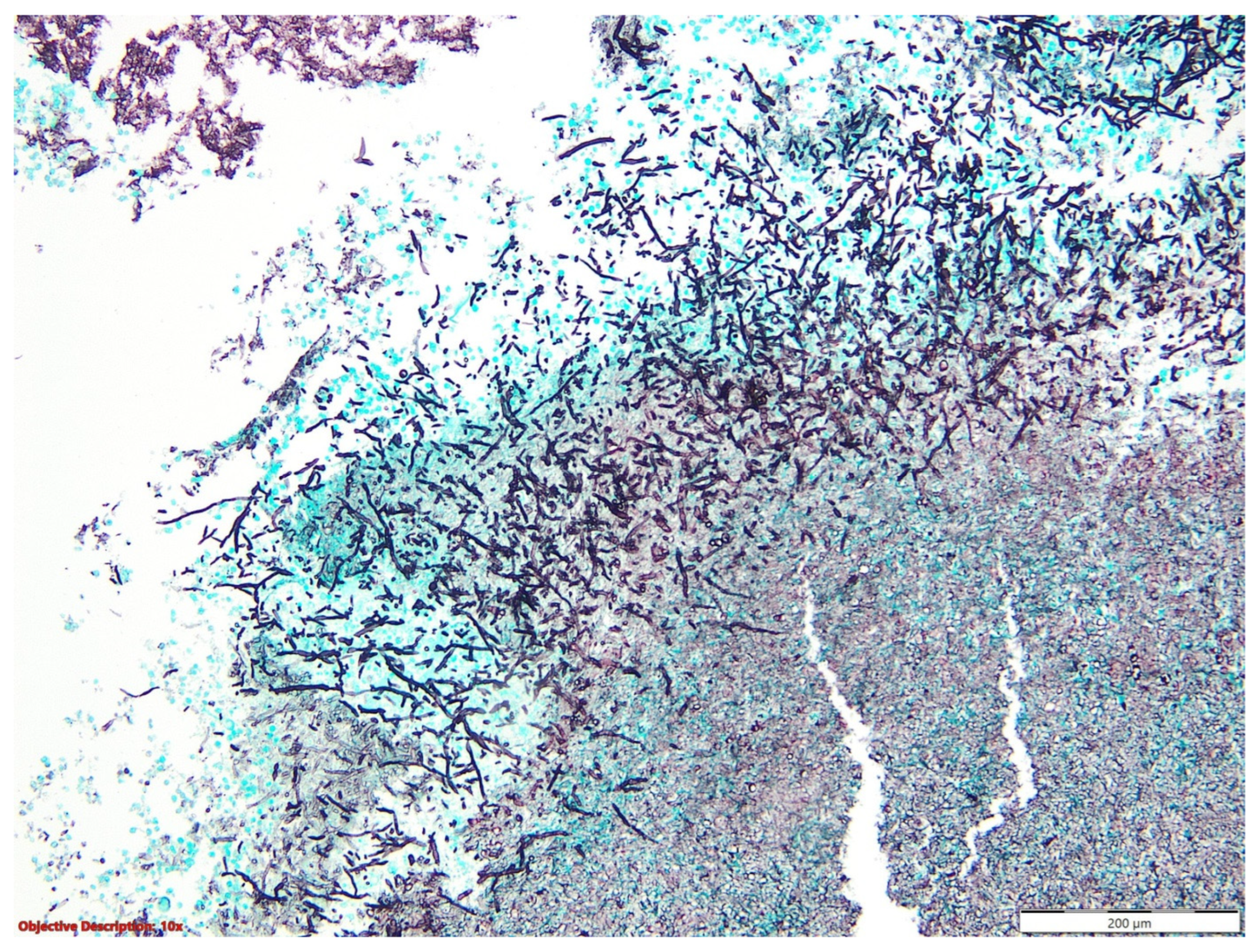 Medicina 60 00112 g009