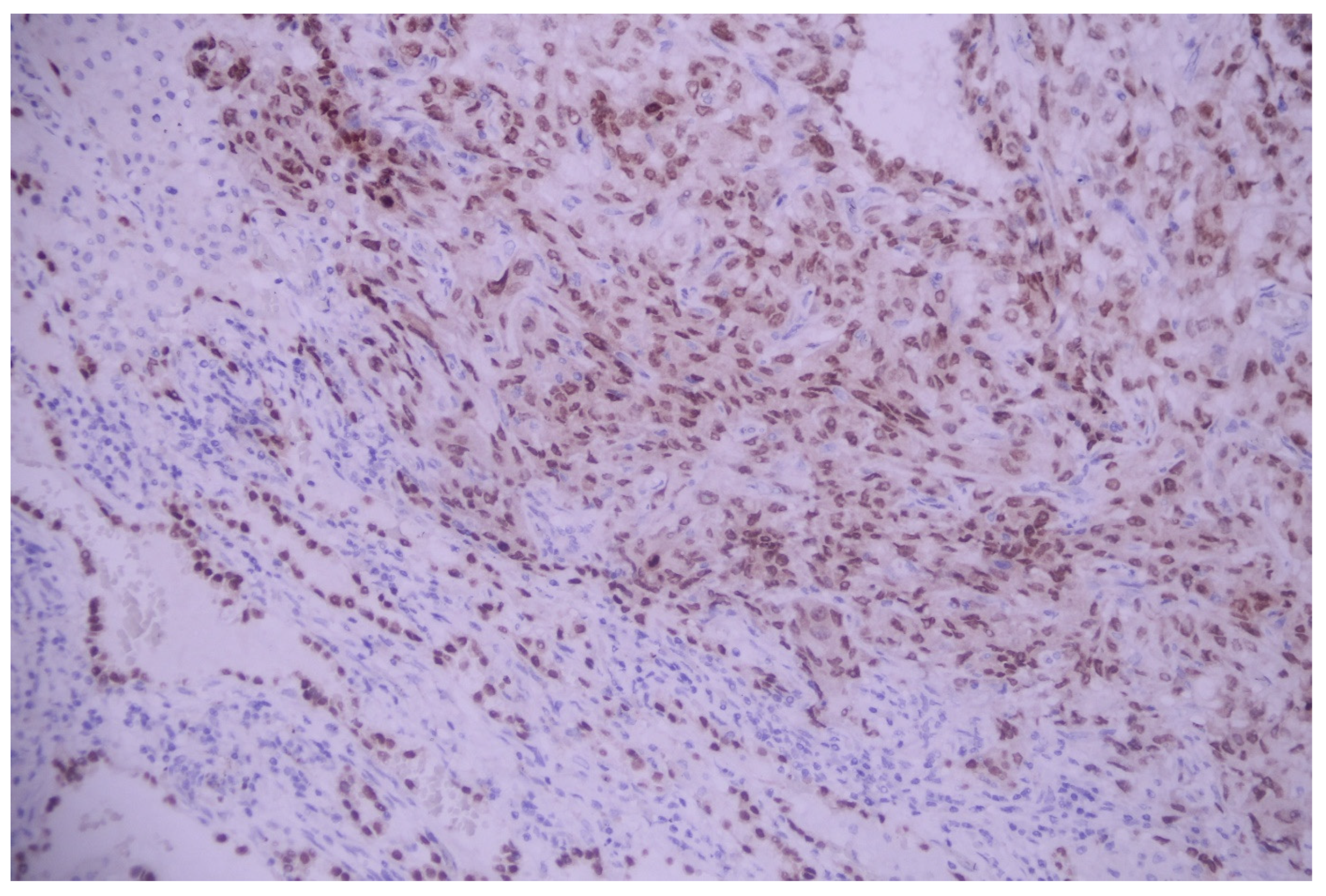 Medicina 60 00112 g011