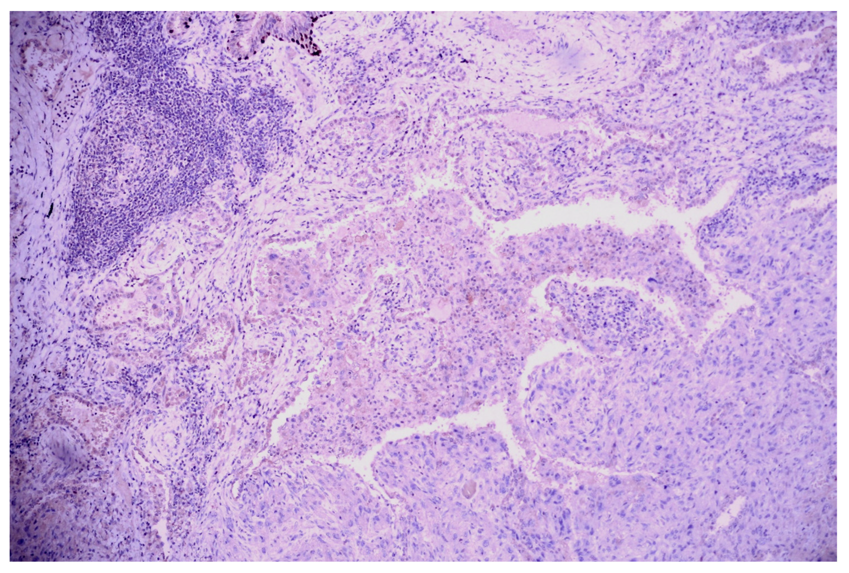 Medicina 60 00112 g012