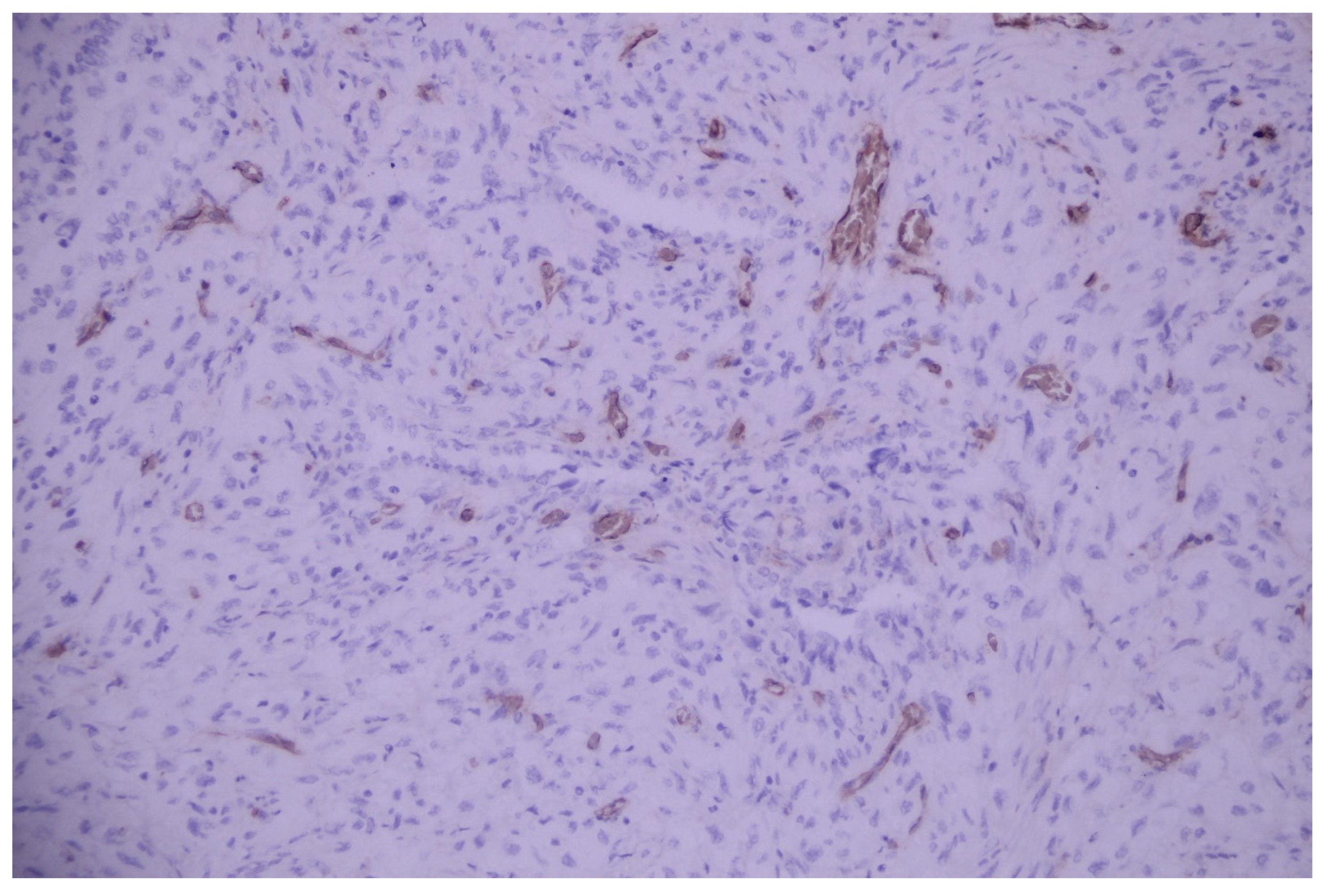 Medicina 60 00112 g014