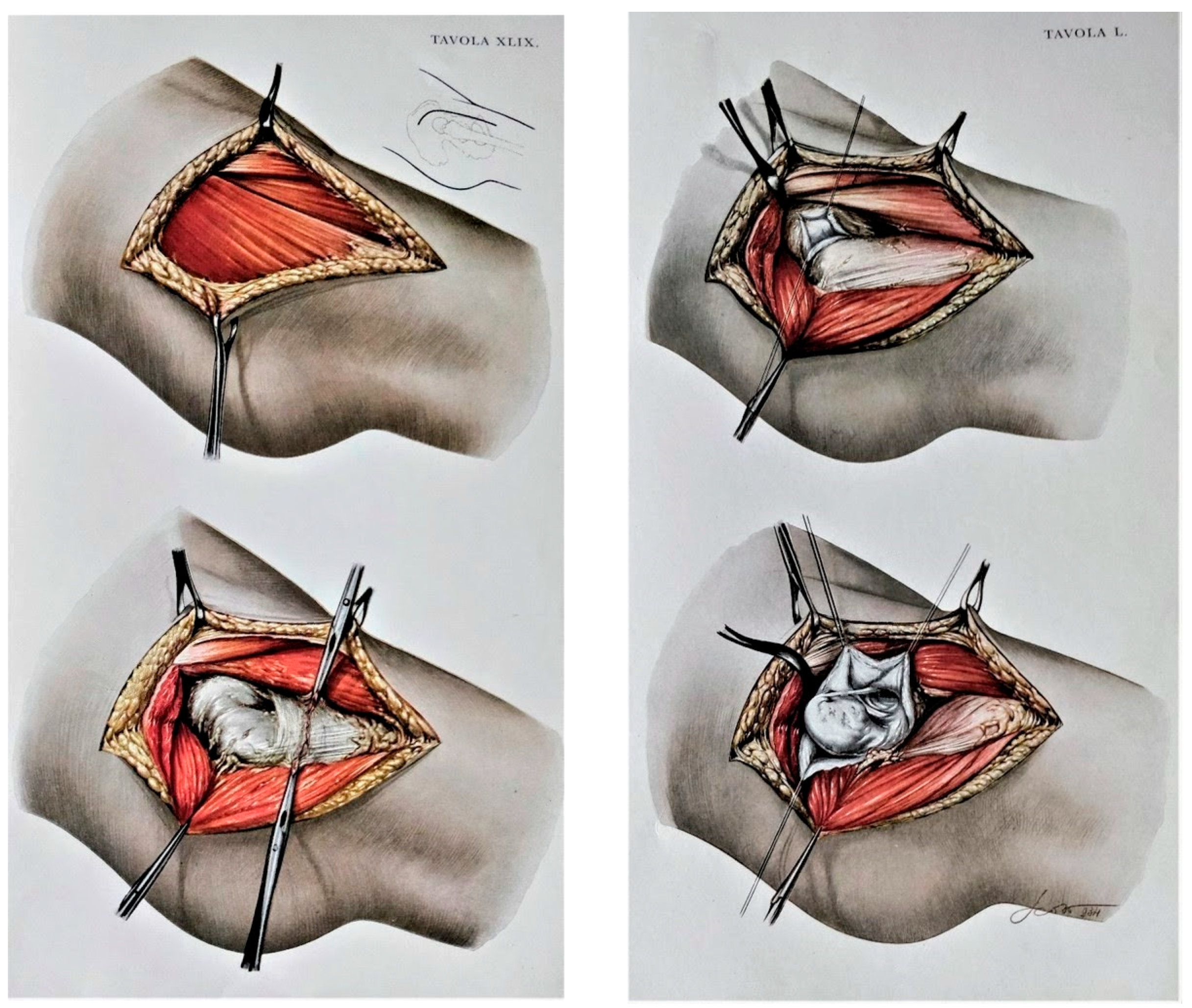 Stock Lower Limb: Orthopedic — Illustrated Verdict