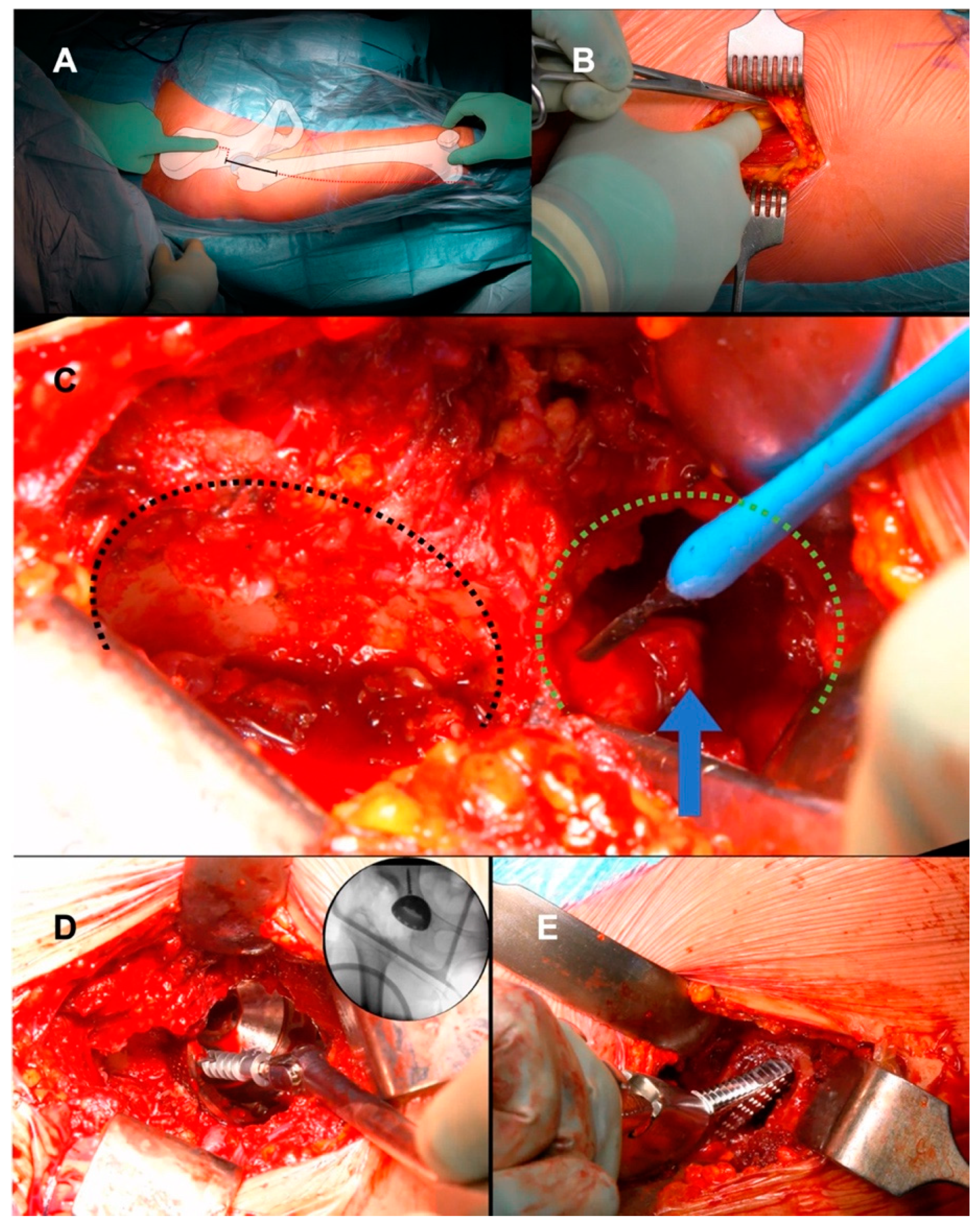Medicina 60 00114 g002