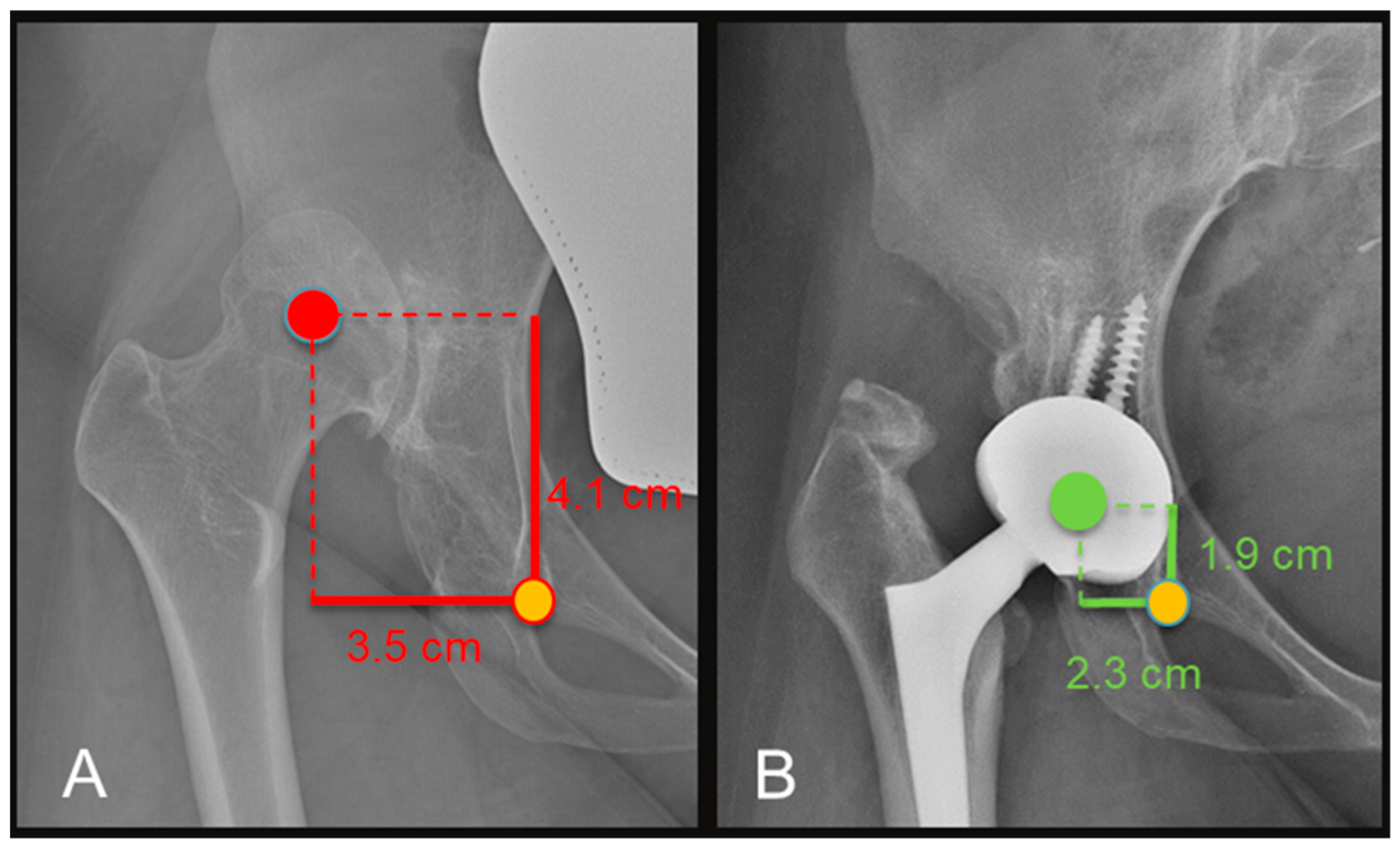 Medicina 60 00114 g004