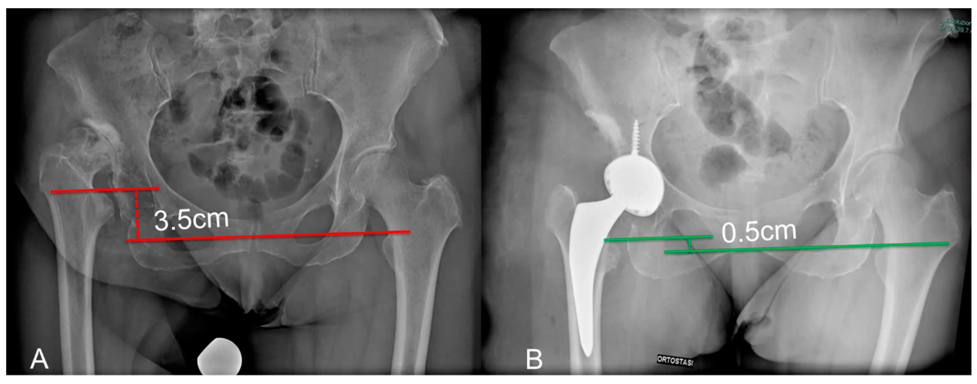Medicina 60 00114 g005