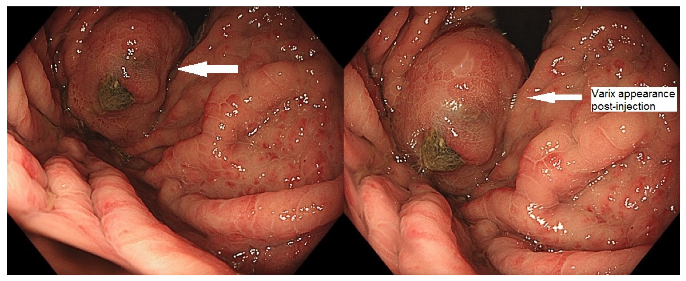 Medicina 60 00116 g001